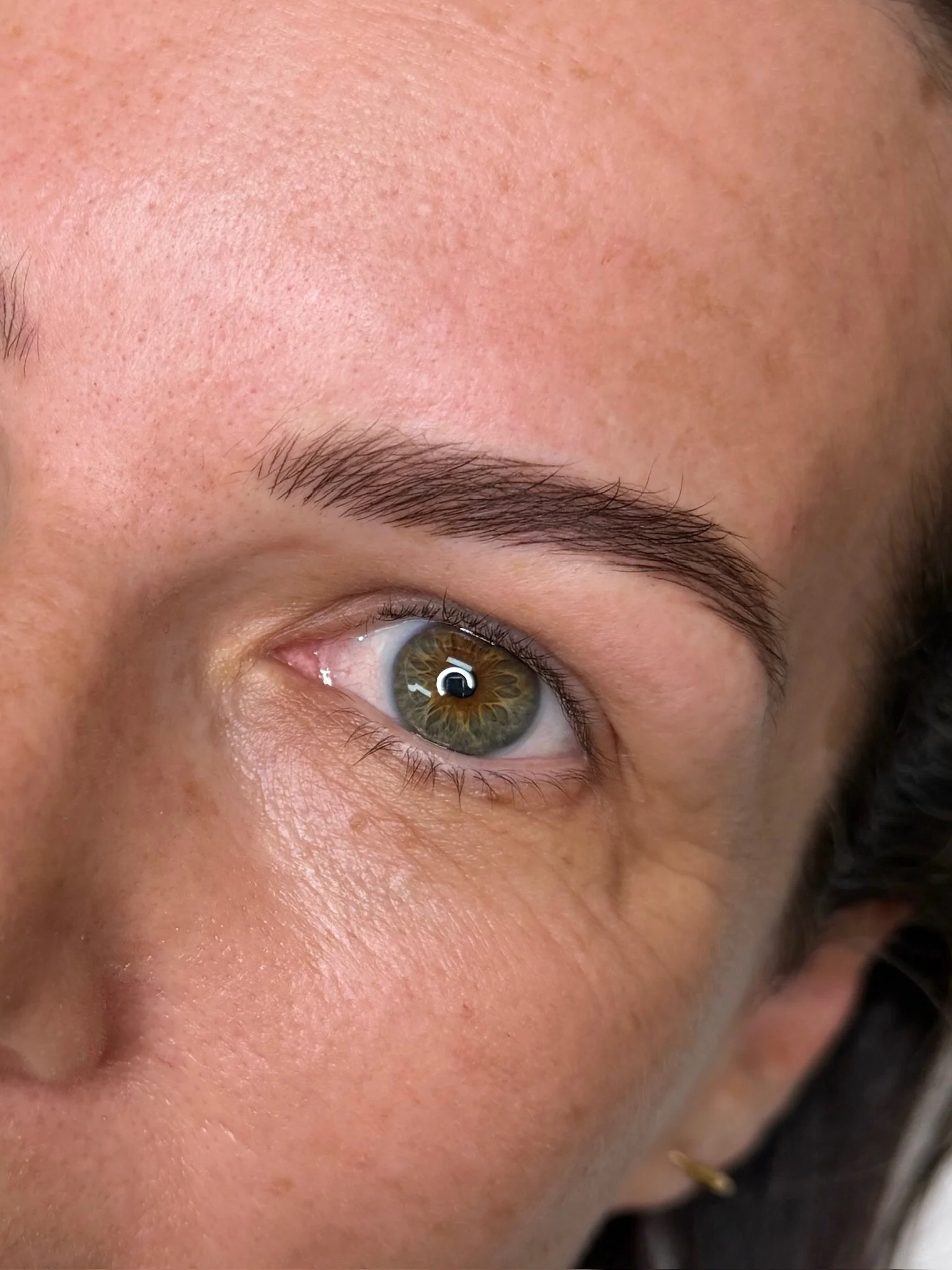 Close-up of a person's face showing part of the forehead, eyebrow, eye, and surrounding skin.