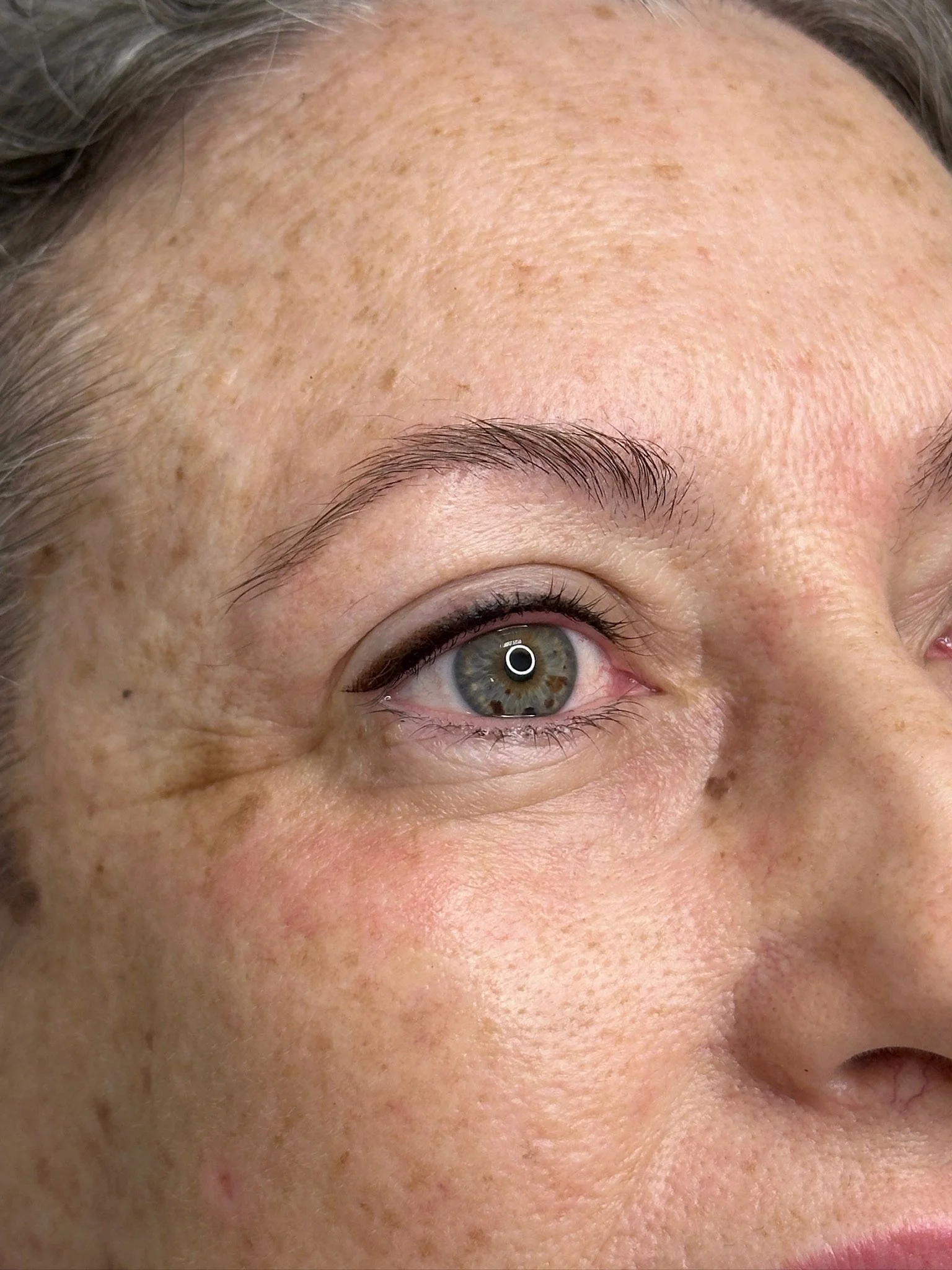 Close-up of a person's face showing their eye, eyebrow, and forehead with visible freckles and skin texture.