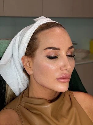 Close-up of a woman with makeup and a white headband, lying with eyes closed in a medical or spa setting.