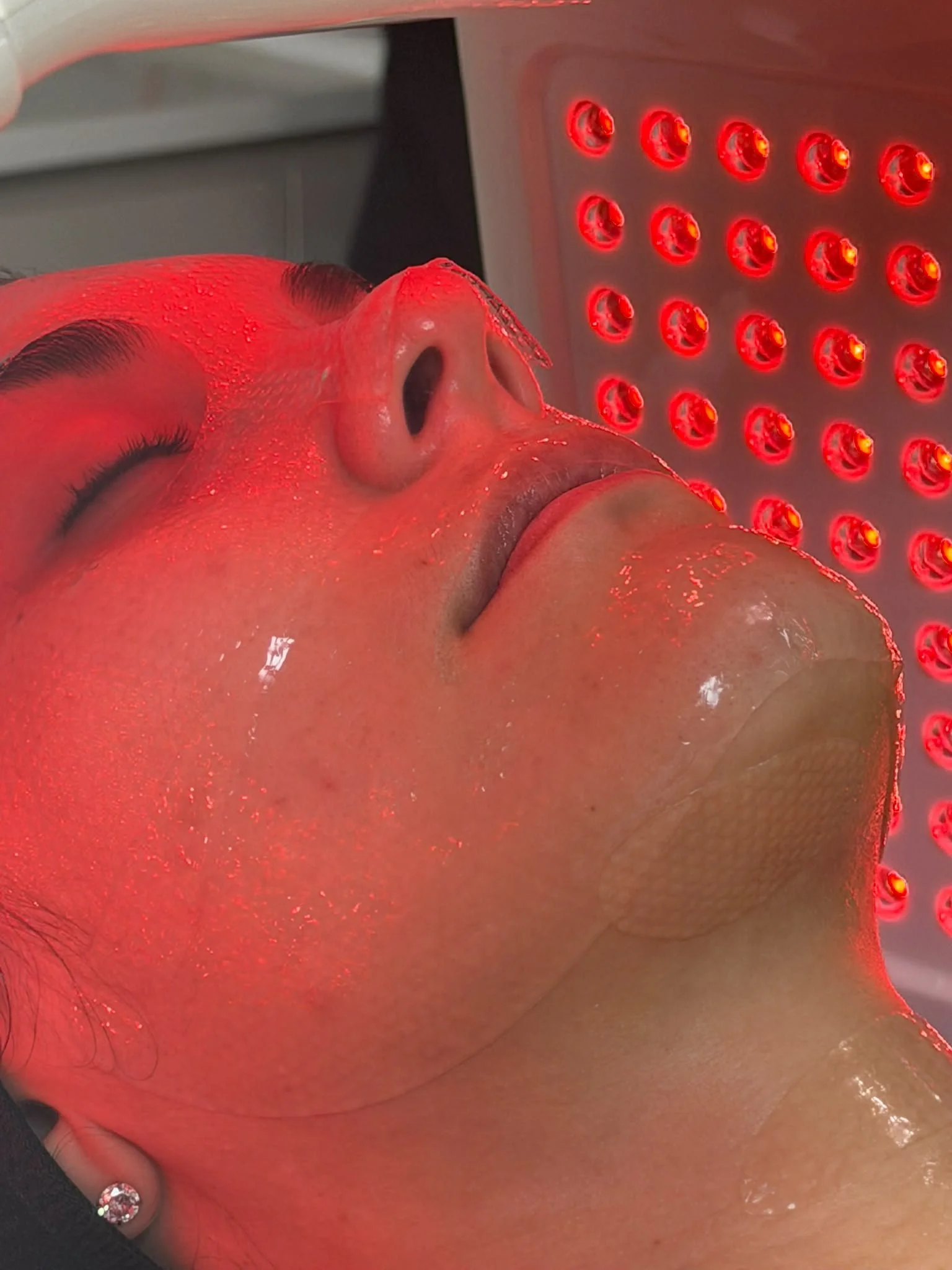 Close-up view of a person receiving LED light therapy treatment on their face, with a red LED light panel nearby.
