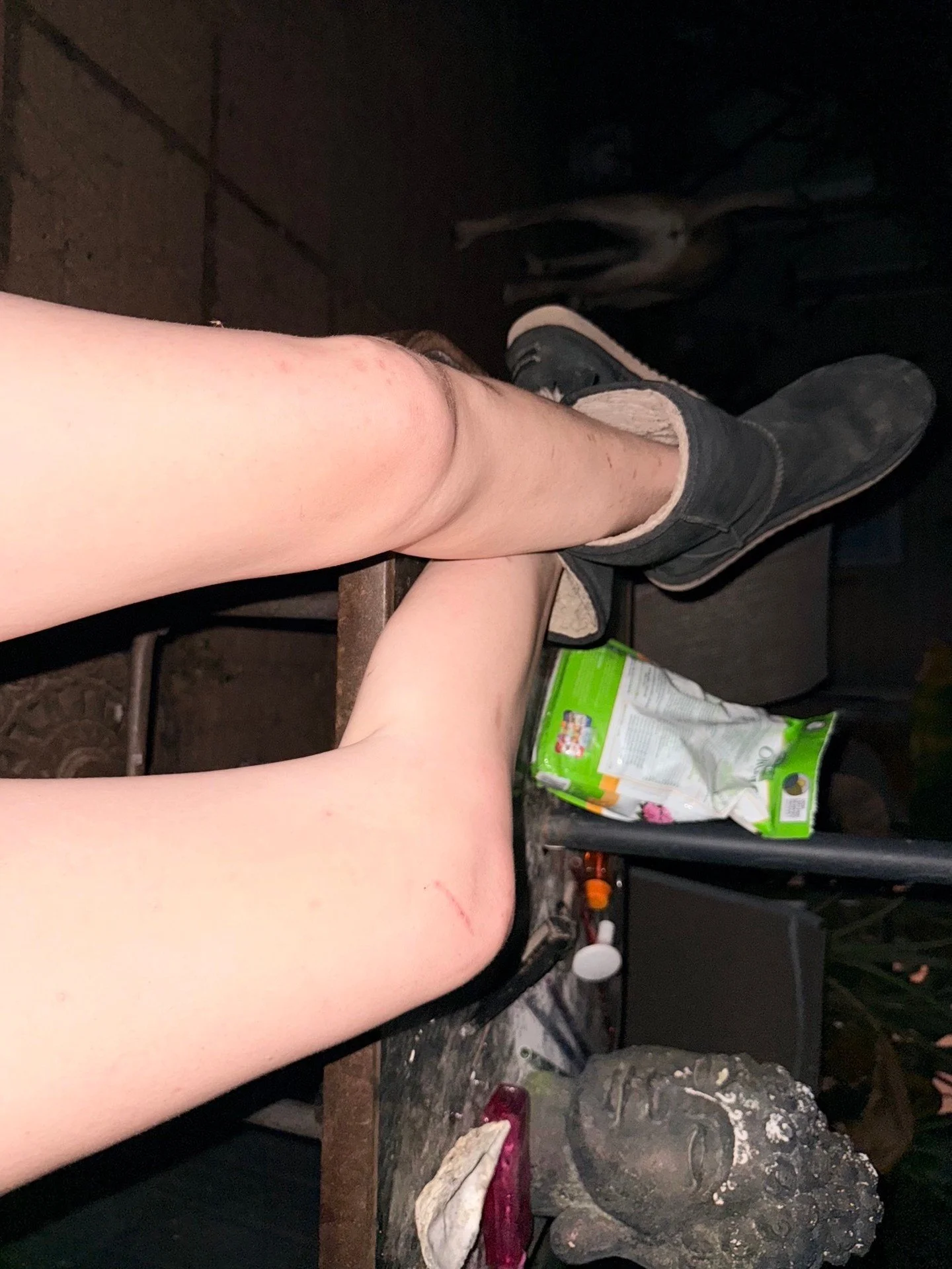 Adventure Uggs. ⛺️👀🌲

#feet #tiredfeet #uggs #womensfeet #barefoot