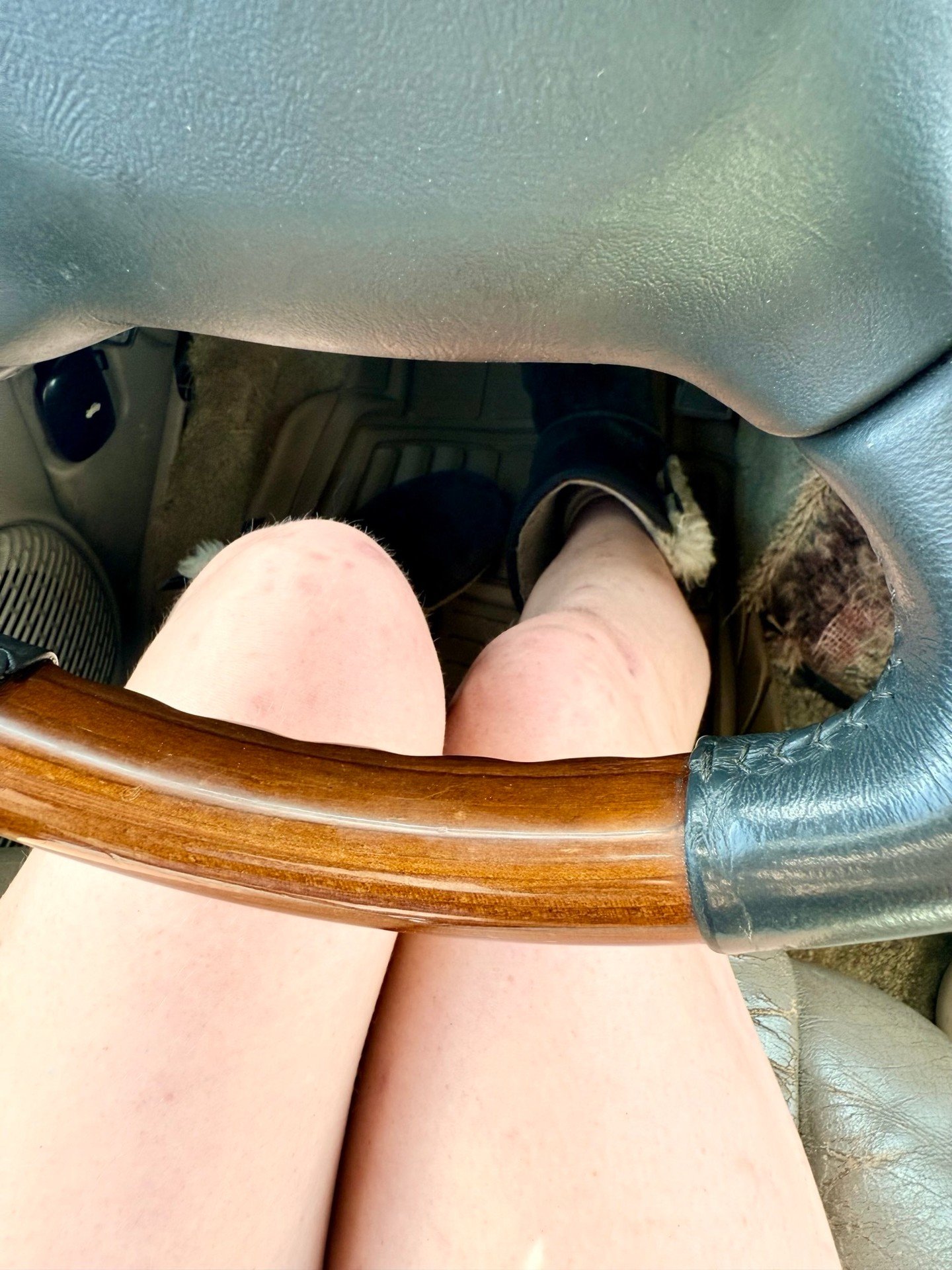 Adventure Uggs? 👁️