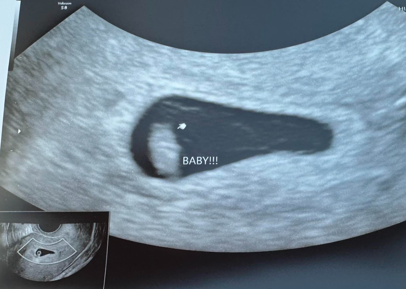 Parker’s First Ultrasound