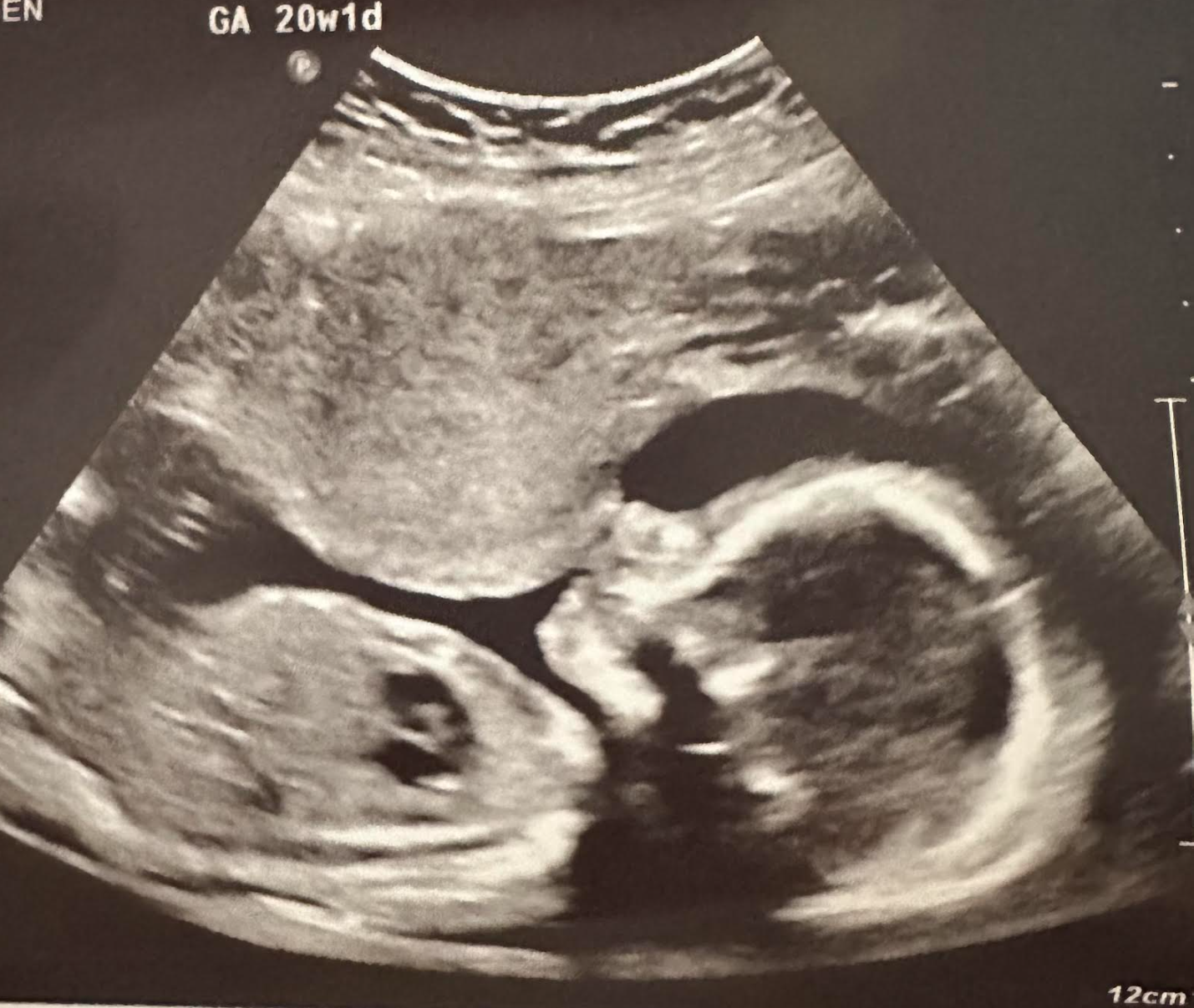 Parker’s Anatomy Scan