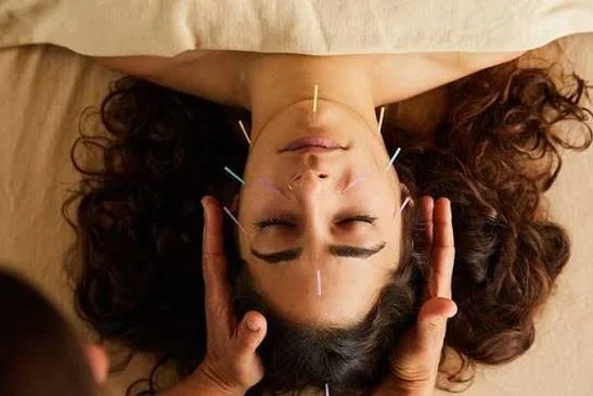 Acupunturist