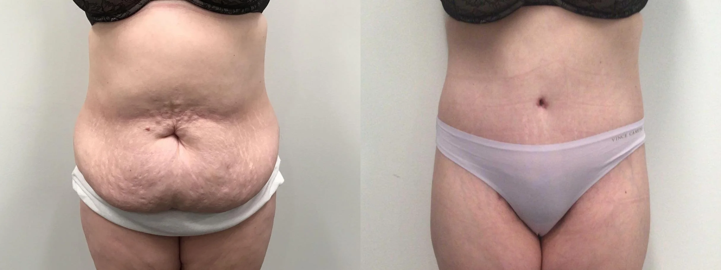 Body Contour Surgeon