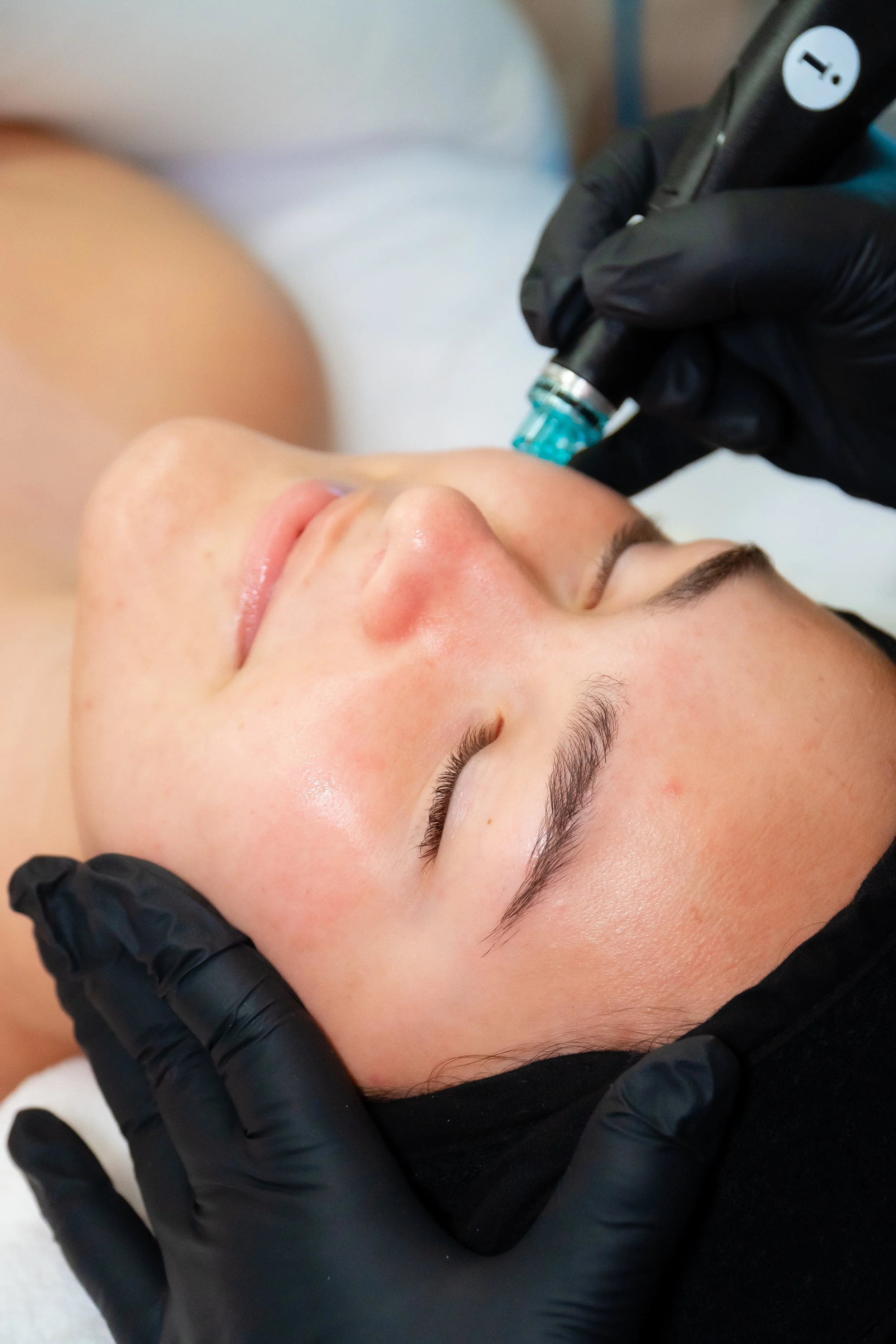 hydrafacialist palm beach gardens