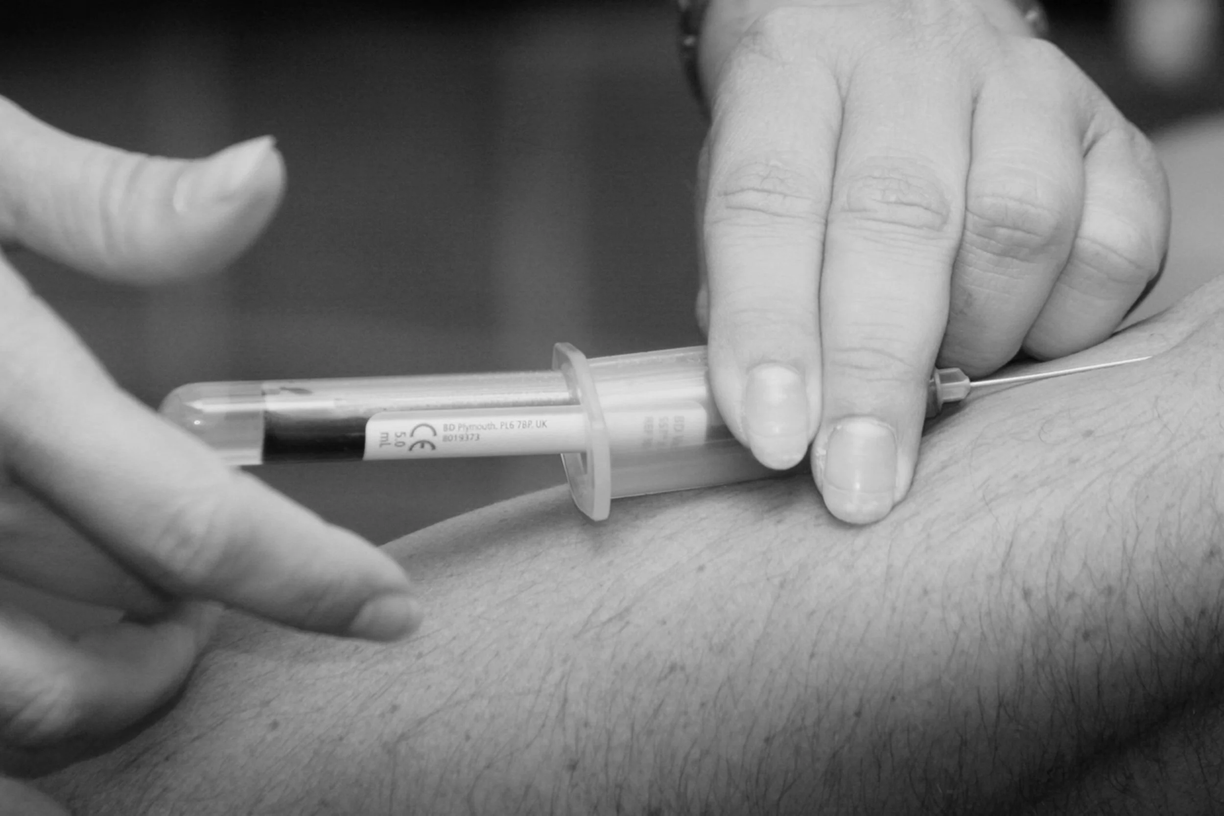 Should I be taking a statin for my high cholesterol?