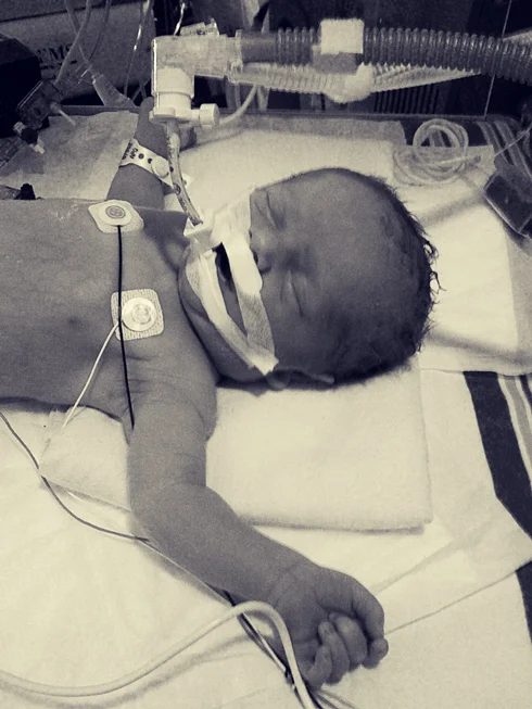Here Luke is two days old. This was taken just before he went in for his first surgery. I remember taking lots of mental images of him, not knowing what the results of the surgery would be.