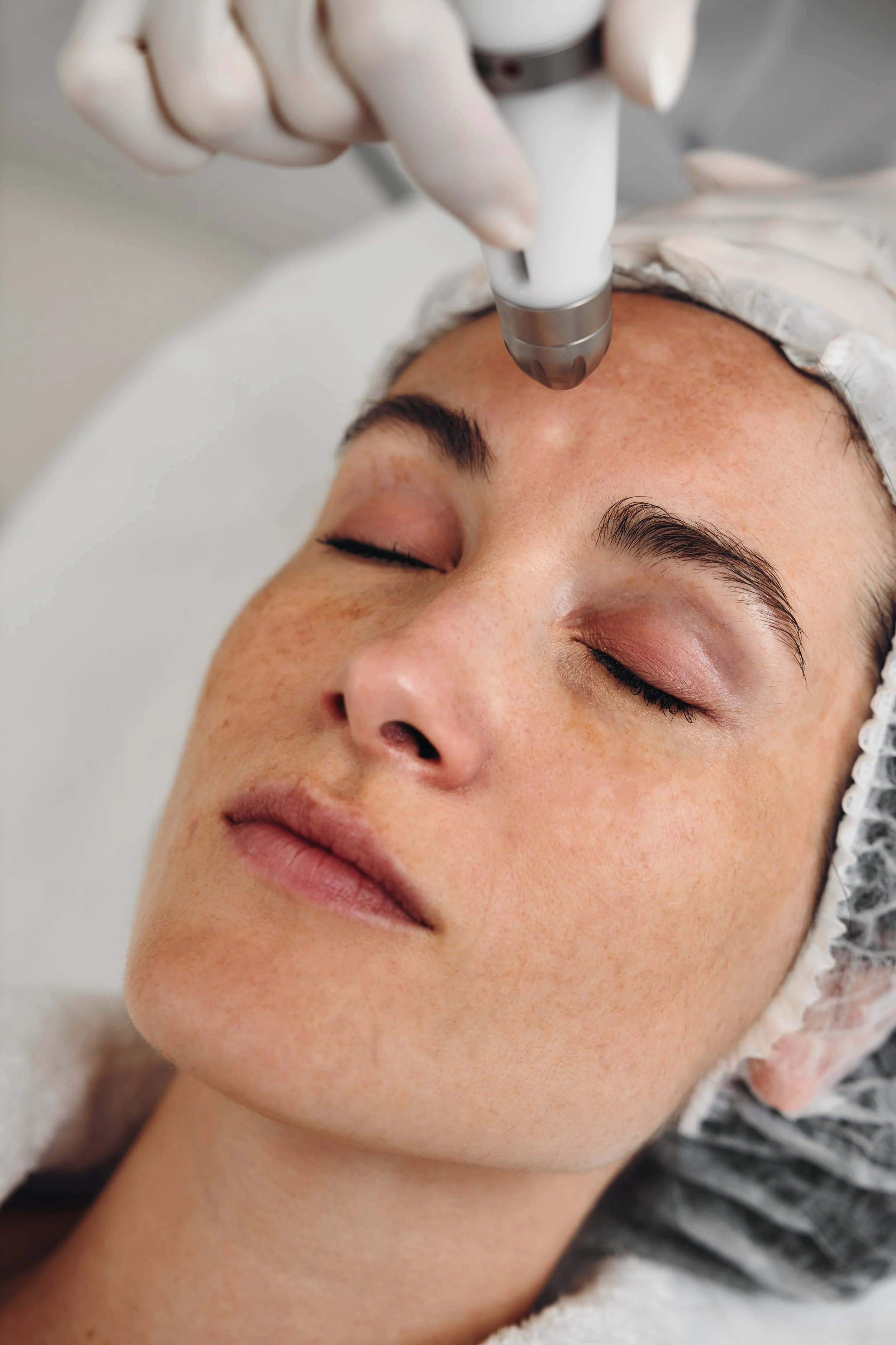 Medspa in Duncansville, PA, 16635 | Microneedling Near Me