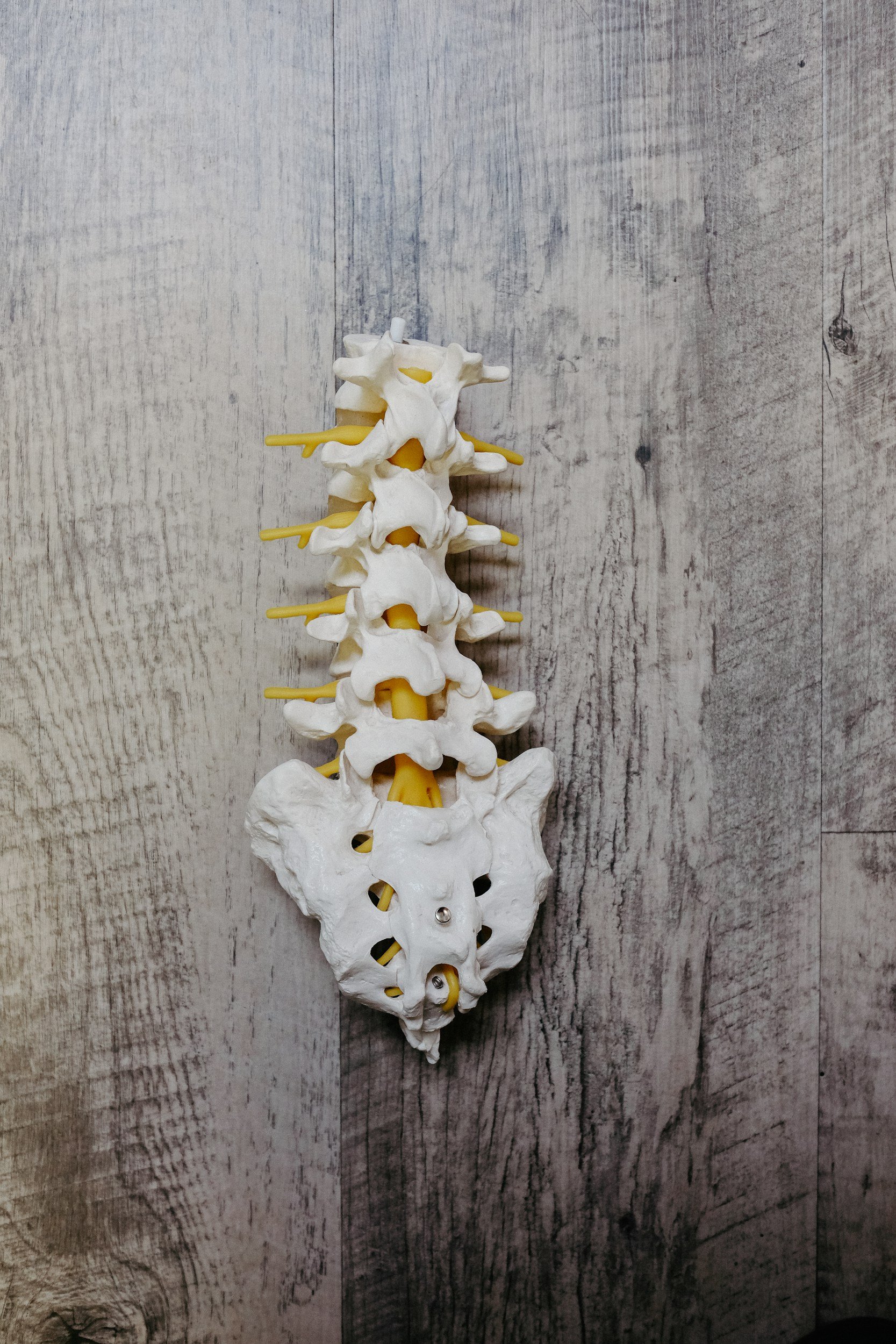 A model of a human spine showing vertebrae and yellow nerves on a wooden surface.