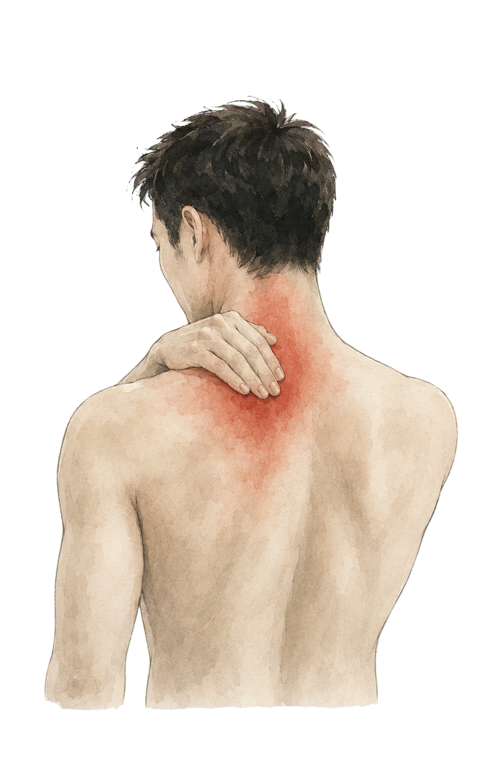 Watercolor illustration of a man with short dark hair, seen from the back, holding his neck with his left hand, showing a red, irritated area on his neck and upper back.