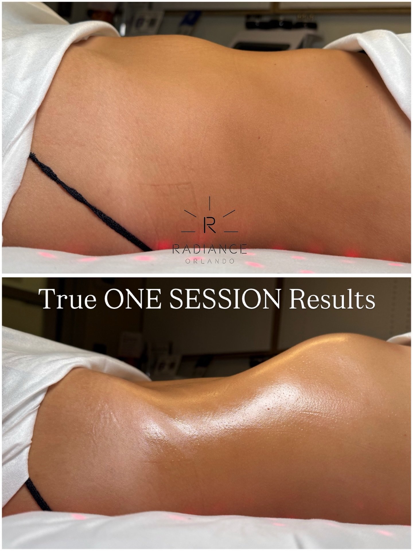 Does your body contouring specialist send you your before &amp; after photos immediately after your treatment?

Ours do.

Because when your results are real, there&rsquo;s nothing to hide.
✨ Real client. ✨ Real results. ✨ Less than 45 minutes. ✨ No f