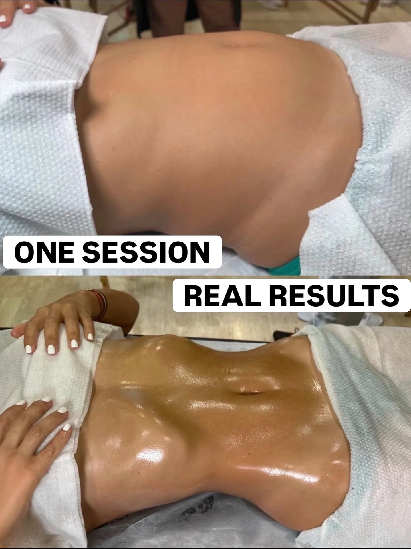 ✨ REAL. ONE SESSION. RESULTS. ✨

We&rsquo;ve heard you! 💛

Radiance Orlando has officially expanded, which means we&rsquo;re DOUBLING our appointment availability starting August 3!

If you&rsquo;ve been waiting weeks to get in or couldn&rsquo;t fin