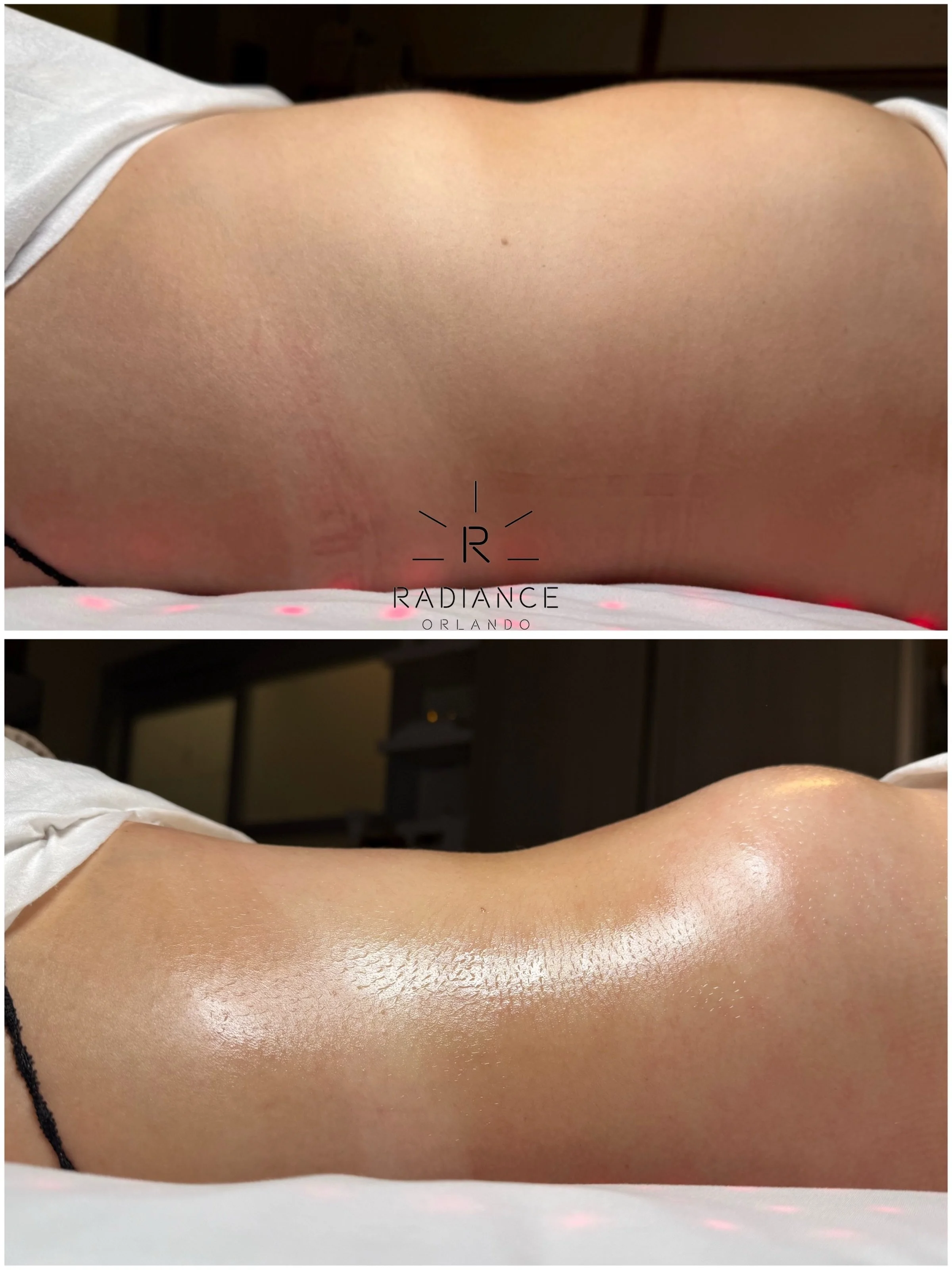ONE SESSION gets their attention. CONSISTENCY changes the game. 🔥

These photos are just 4 sessions apart.

Yes, we&rsquo;re known for visible results after a single session. But when your goal is real, progressive body transformation, the magic is 