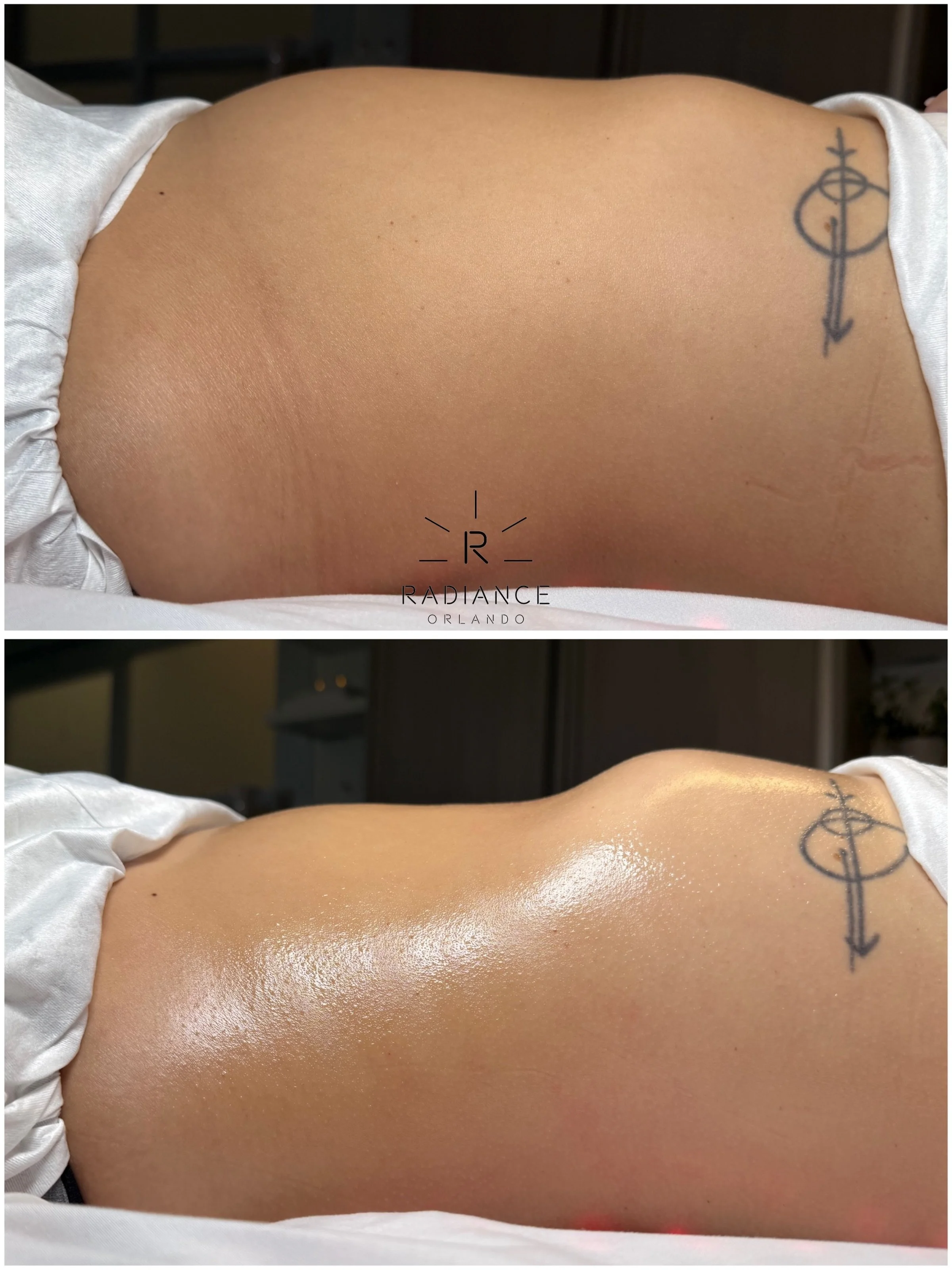 BLOATING CAN CHANGE YOUR ENTIRE SHAPE. 😒

And sometimes, the difference ONE SESSION can make speaks for itself.

This client came in carrying significant abdominal bloating and fullness. After ONE Extreme Stomach Sculpt session, look at the differen