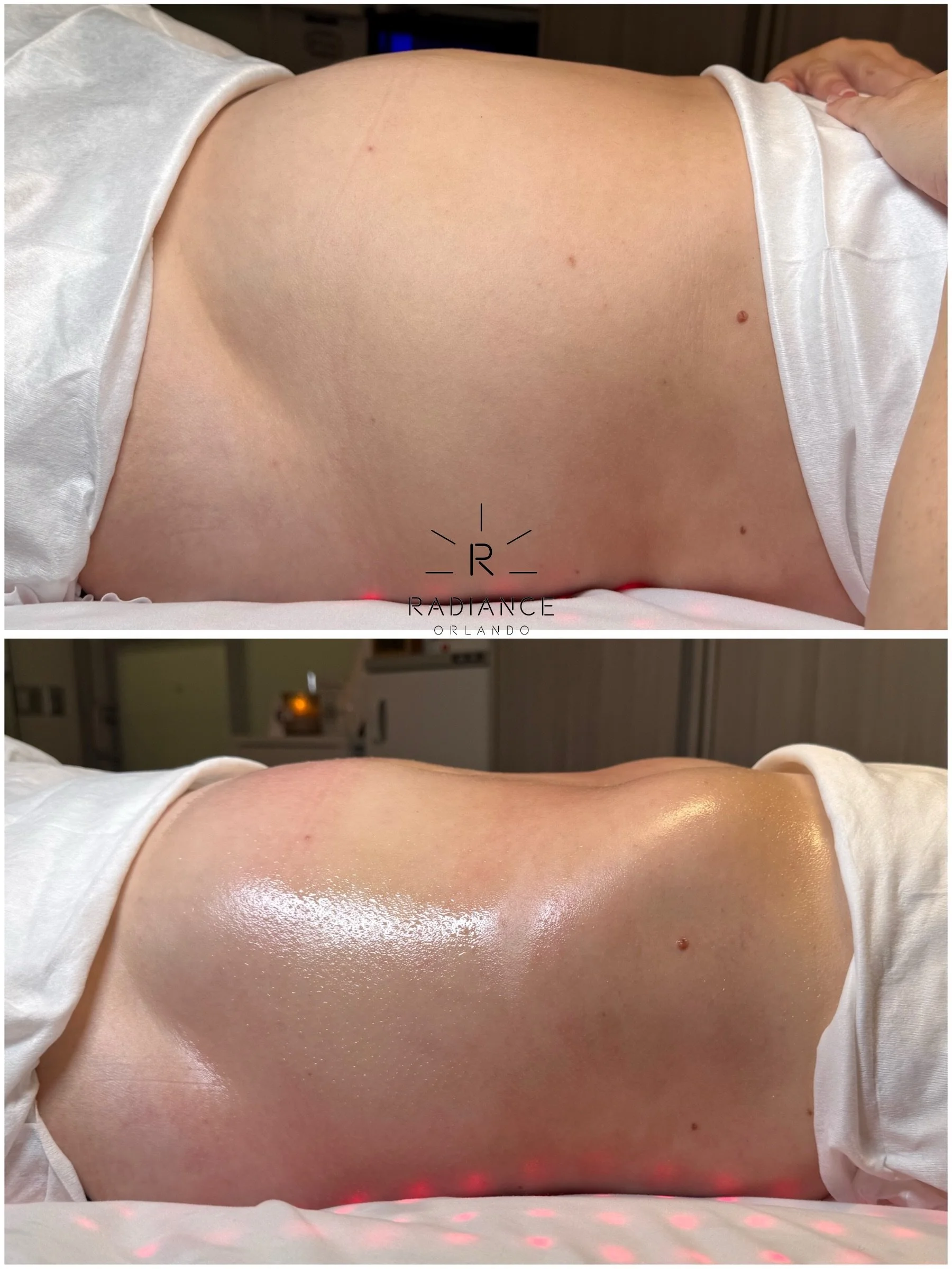 Let&rsquo;s be real&hellip;. some stomachs move MORE than others. 

And even with our package clients, every session can look a little different. One week their stomach may respond dramatically and another week the change may be more subtle.

Why? Be