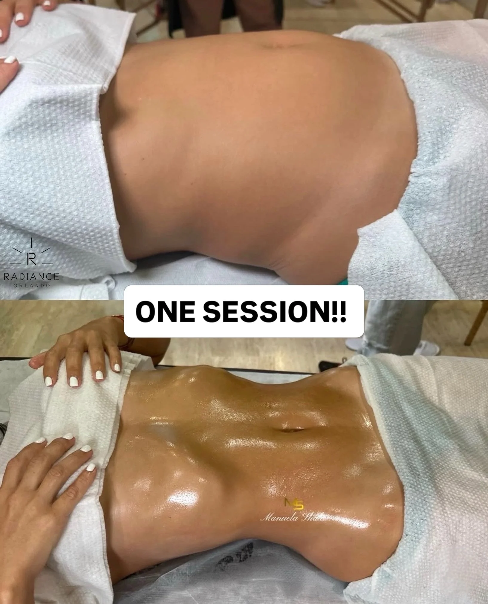 One session. Same client. 🤍

Holiday ready starts now!!!! Manuela Shala trained team, one of the few in the U.S.

🎄 Limited spots left in October and November

📍 Dr. Phillips, Orlando

👇 Book your first session
  RadianceOrlando.com

Results vary
