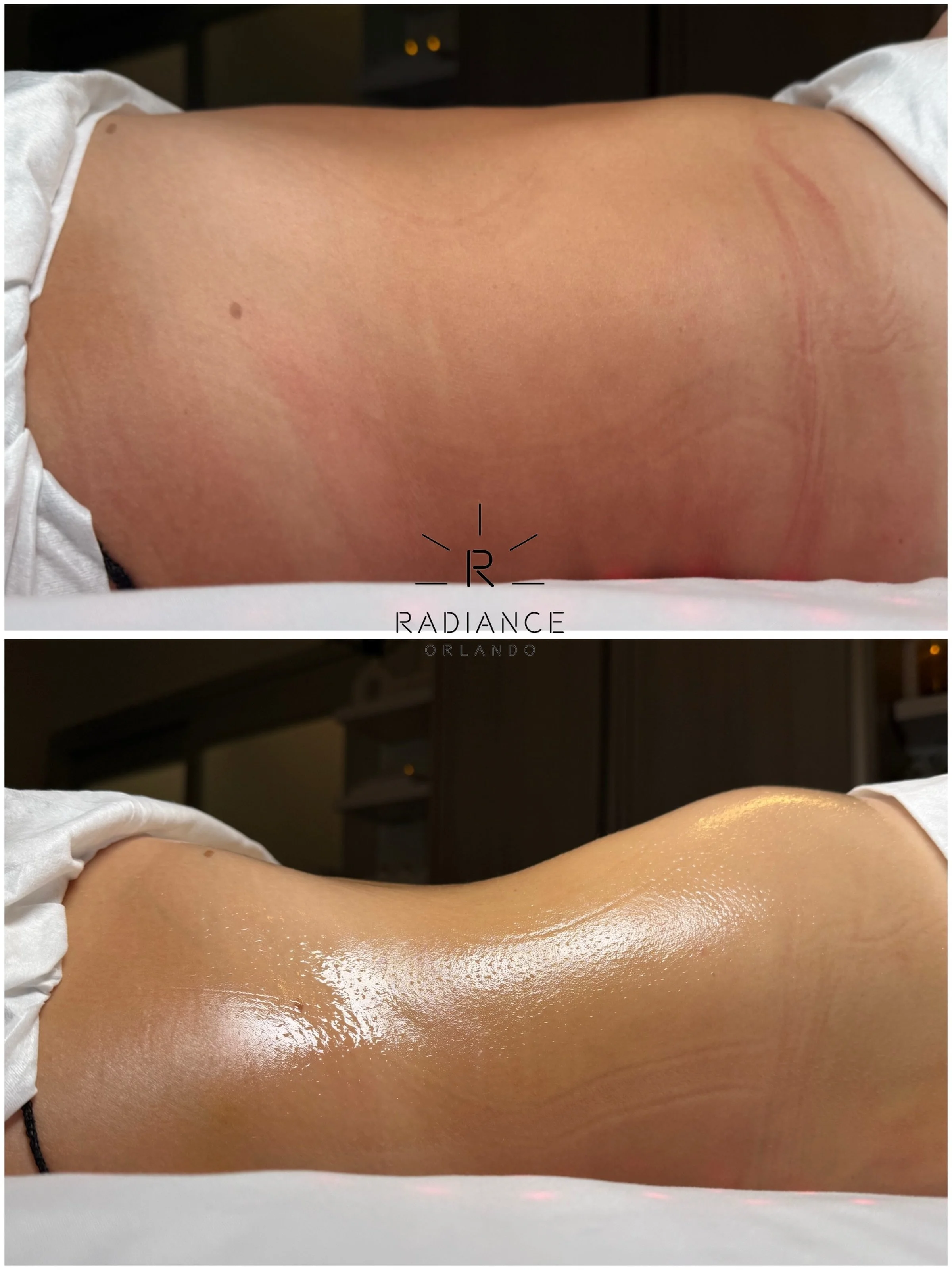 ONE SESSION gets attention. A SERIES is where the transformation happens. 🔥

This is our client after just her THIRD Stomach Sculpt session&mdash;and LOOK at this difference.

We&rsquo;re known for our incredible one session results, and yes, most o