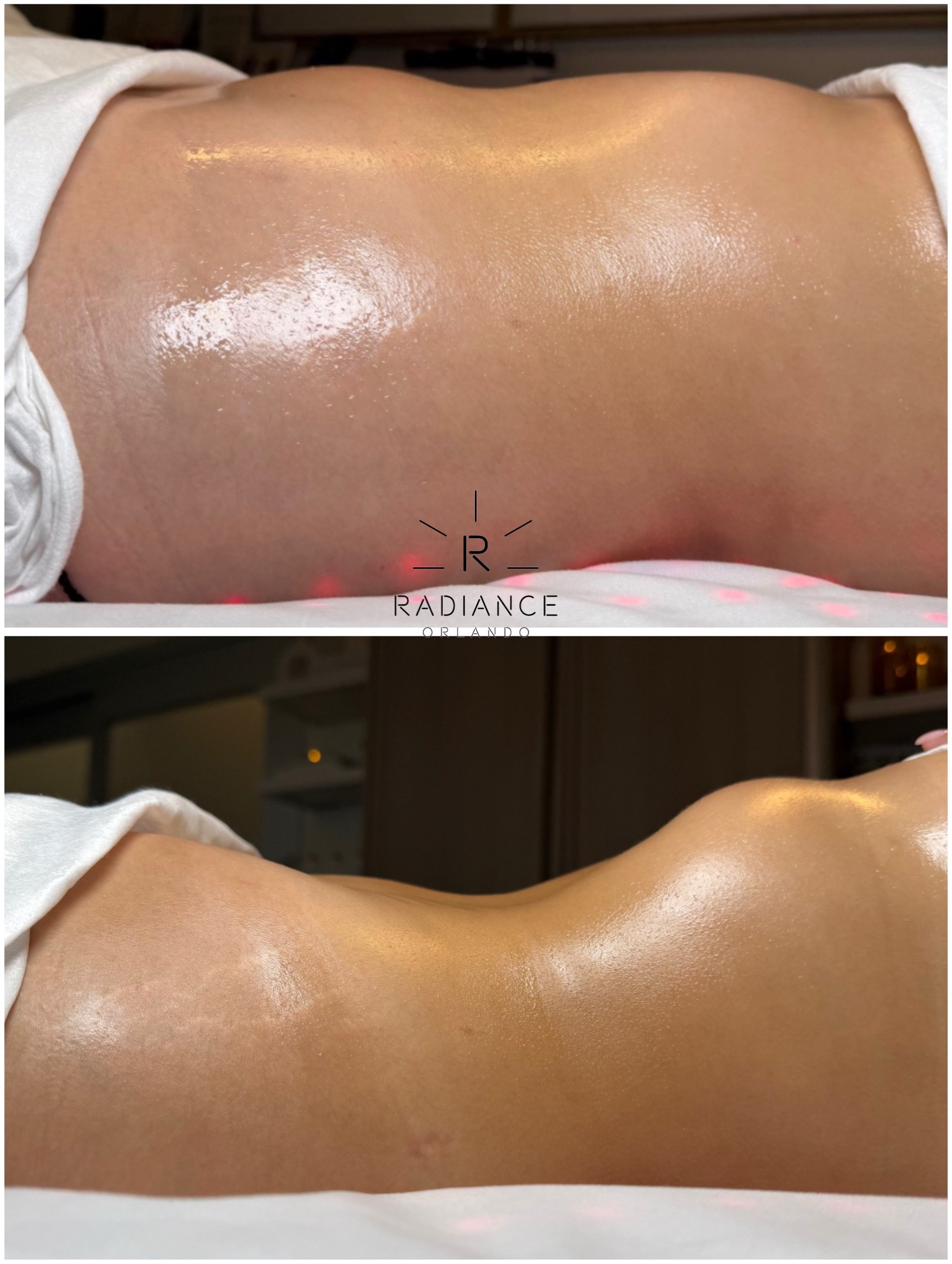 ONE SESSION GETS YOUR ATTENTION. FOUR SESSIONS TELL A BIGGER STORY. 🔥

Yes, we specialize in visible results after just ONE session. And yes, this client saw an incredible difference after her very first visit.

But what you&rsquo;re seeing here? He