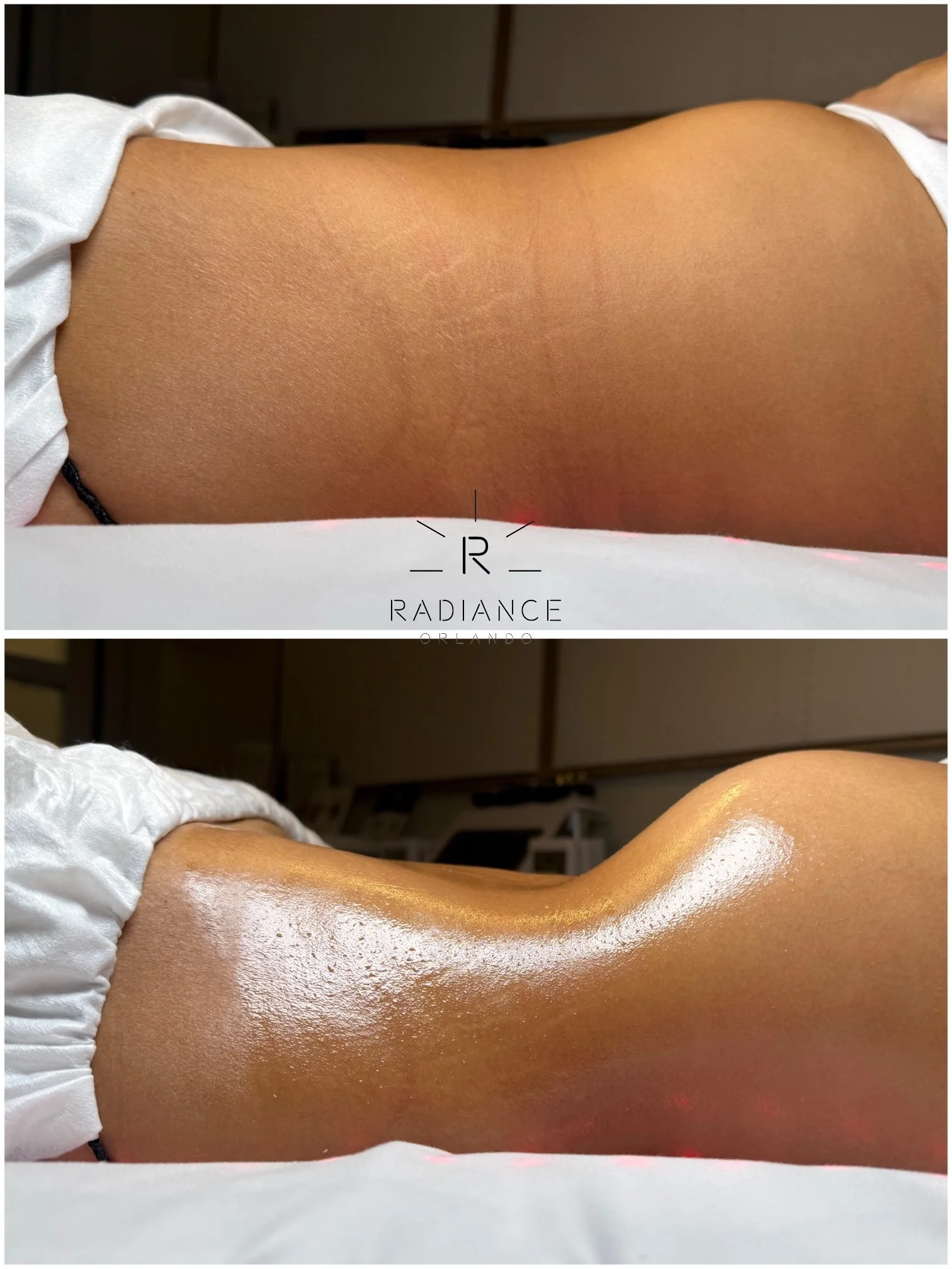 ne-session-body-sculpting-results-orlando-01.jpg / -02.jpg