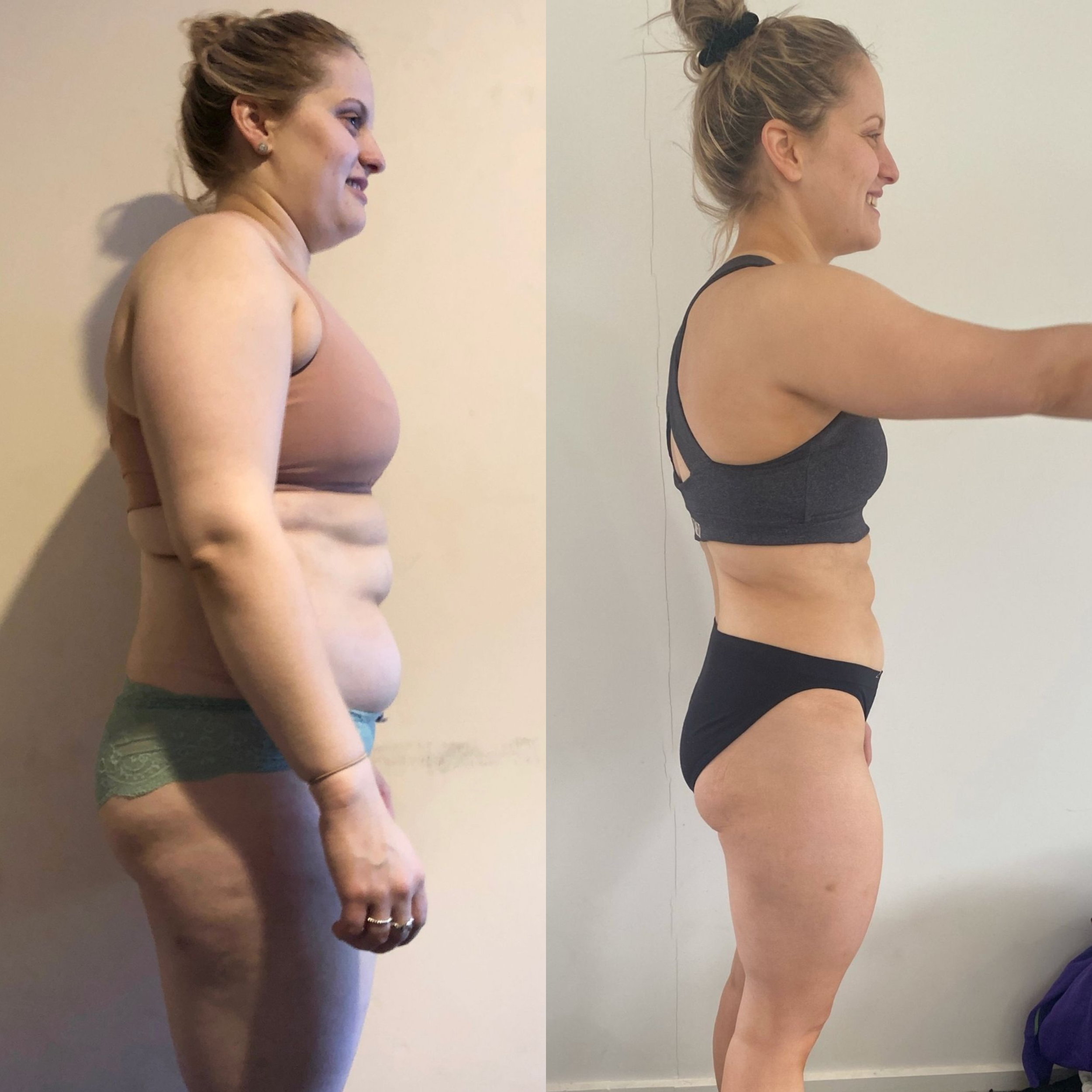 Comparison of a woman before and after weight loss, standing in profile with arms extended forward.