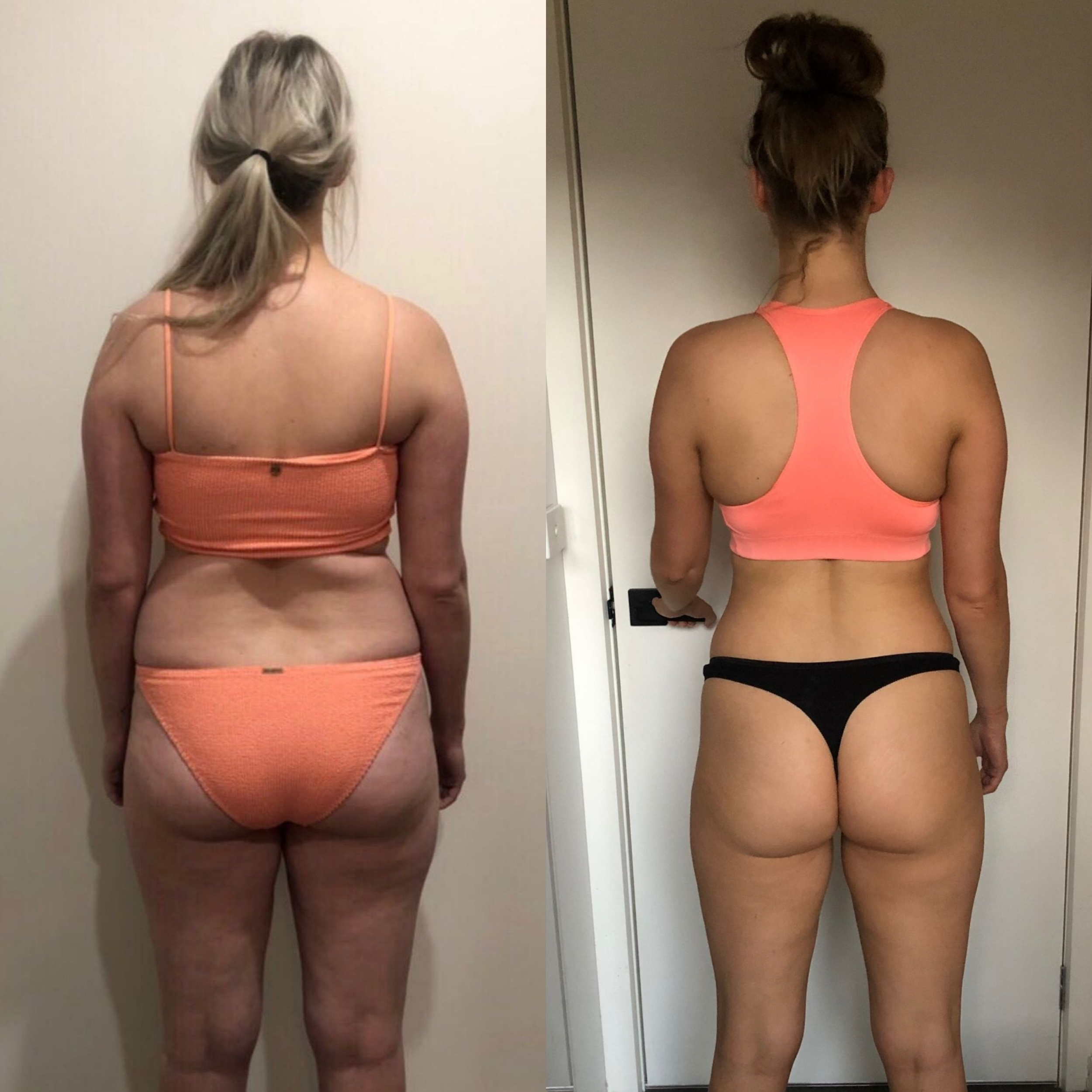 Comparison of the back view of a woman before and after weight loss. The left side shows initial condition with more body fat and loose skin, while the right side shows after weight loss with a toned appearance, wearing similar clothing.