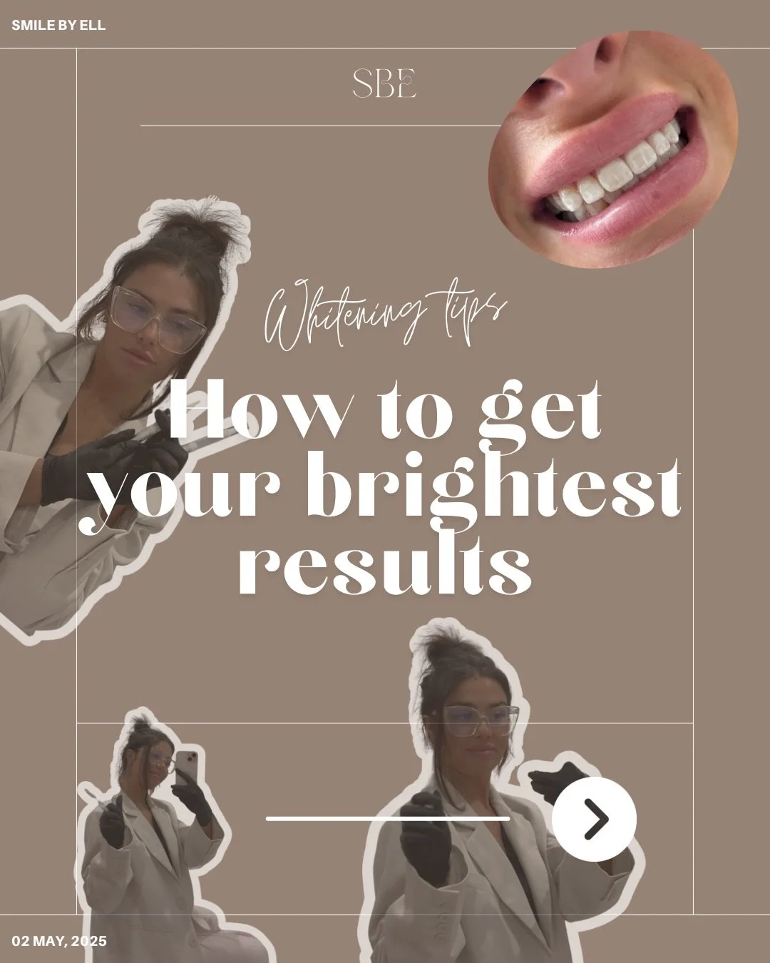 I&rsquo;m a coffee lover so I do get it. It&rsquo;s the biggest question when it comes to whitening. &ldquo;What can I eat and drink after?&rdquo; My whitening experiences include a full personalised consultation and aftercare bag with all the instru