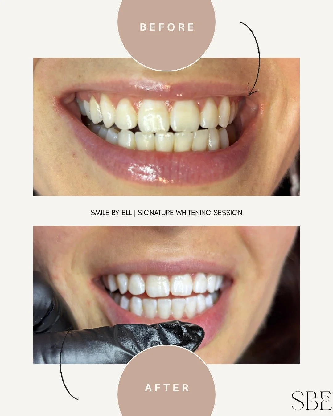 More stunning results with the SBE Signature Treatment 

Book yours today with the link in my bio 🤍🫶🏽