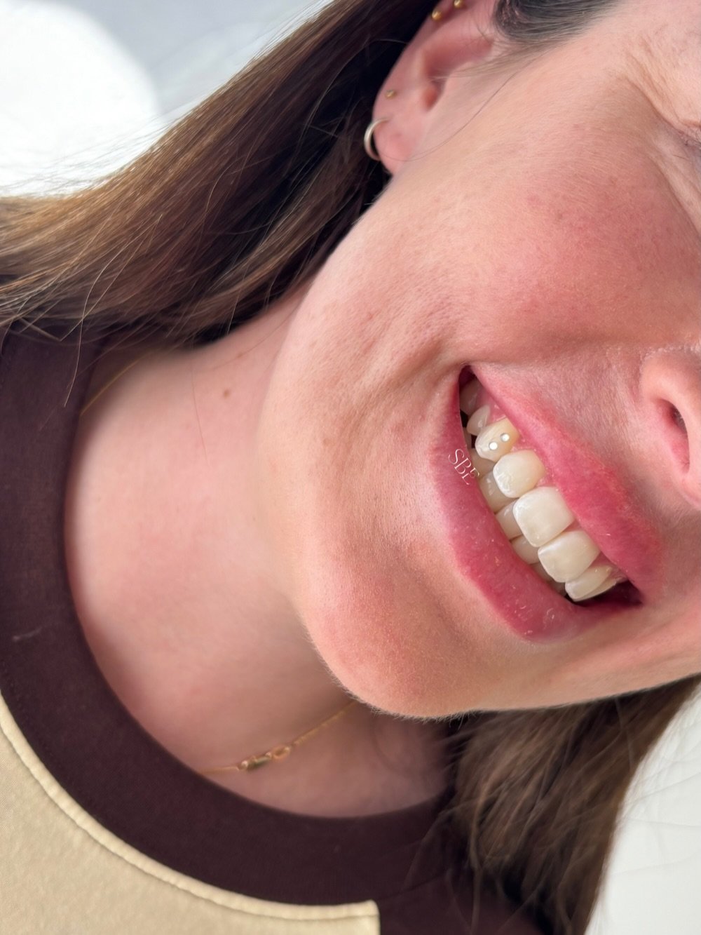 Your new tooth gem inspo 🦷✨

#toothgemsnewcastle #teethwhitening #toothgeminspo #maitland