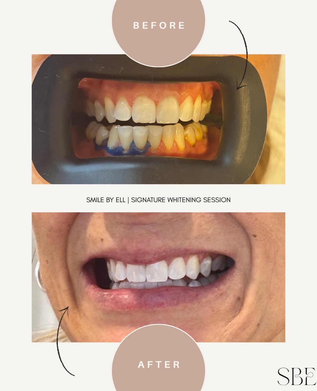 Another day another before photo where I forget the pic before I put the barrier on 🥲 how goods this transformation 😍 never thought I&rsquo;d have a high school principal in my chair after what I&rsquo;ve done as a teenager 🤭

#beforeandafter #tee