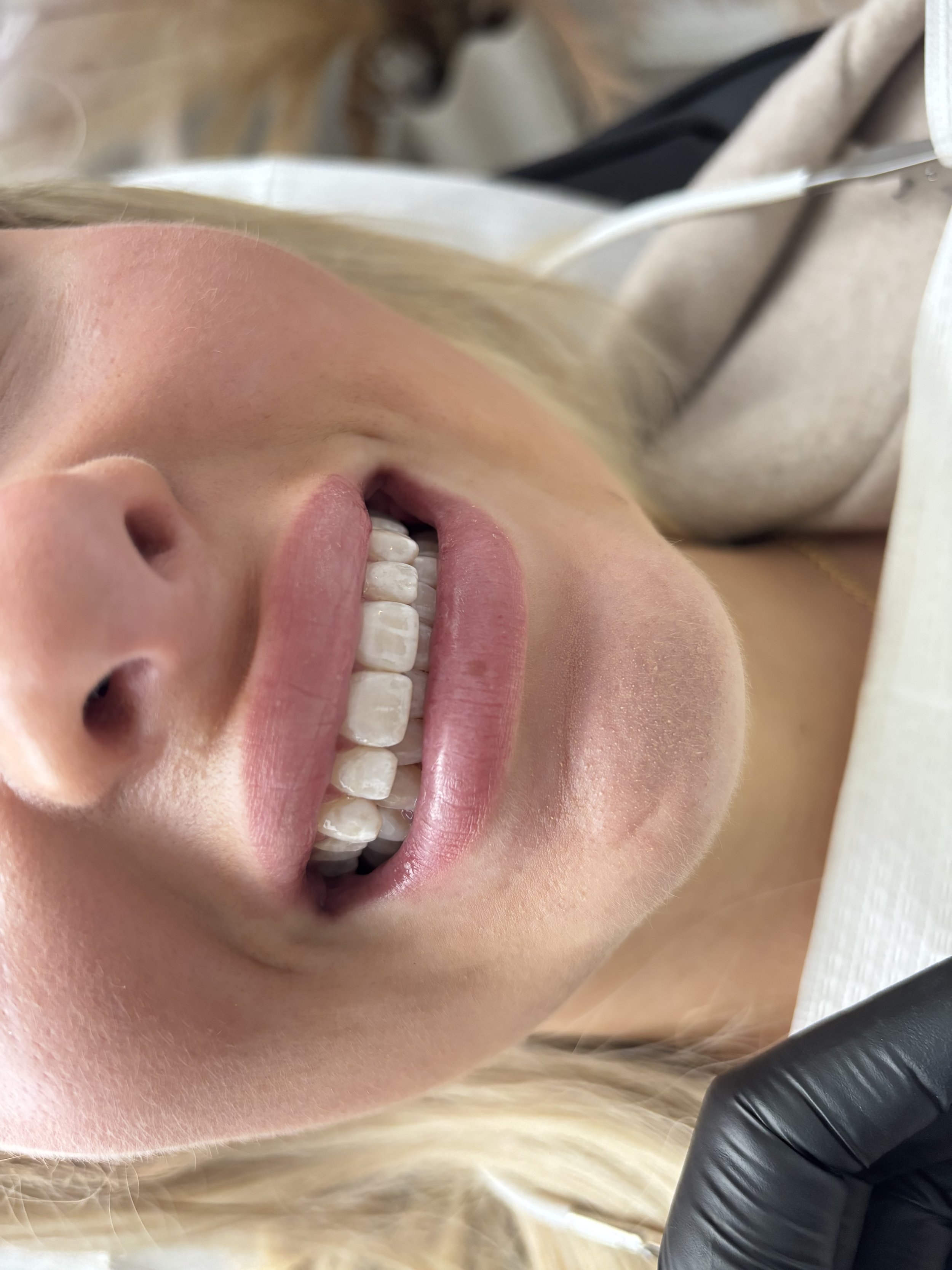 SBE Signature Whitening