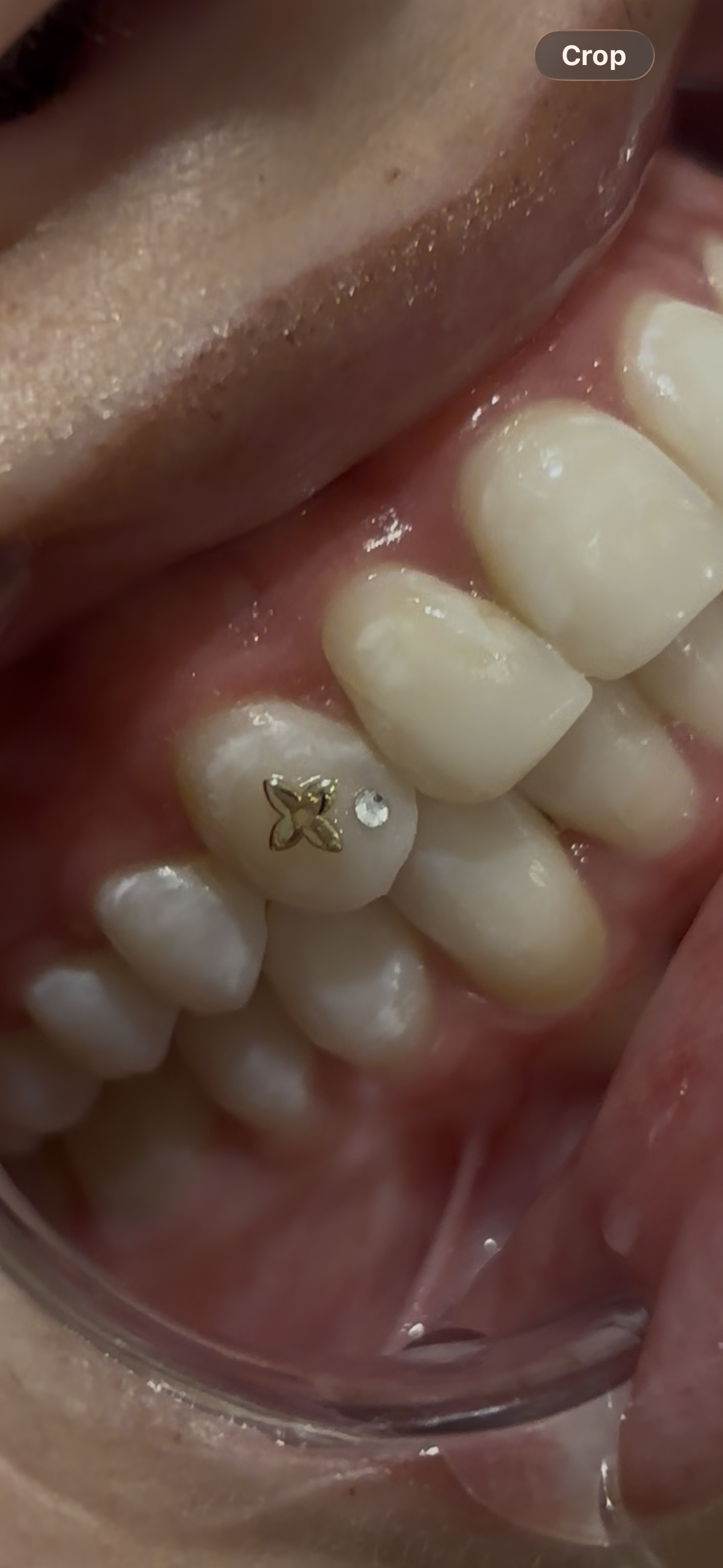 18k Gold Tooth Gems