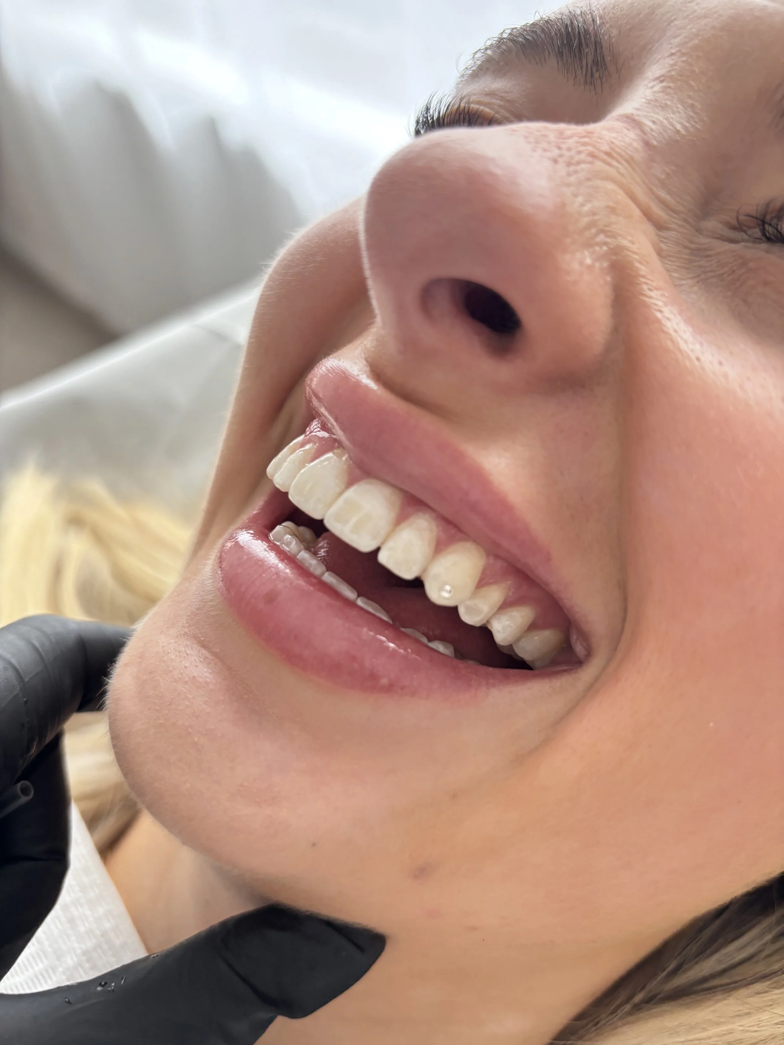 Swarovski Tooth Gems