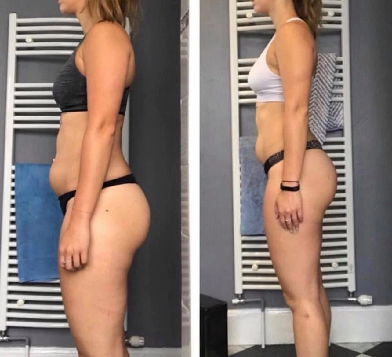 Side-by-side comparison of a woman's body in the before and after, showing weight loss or fitness progress, in a room with a white radiator and blue towel in the background.