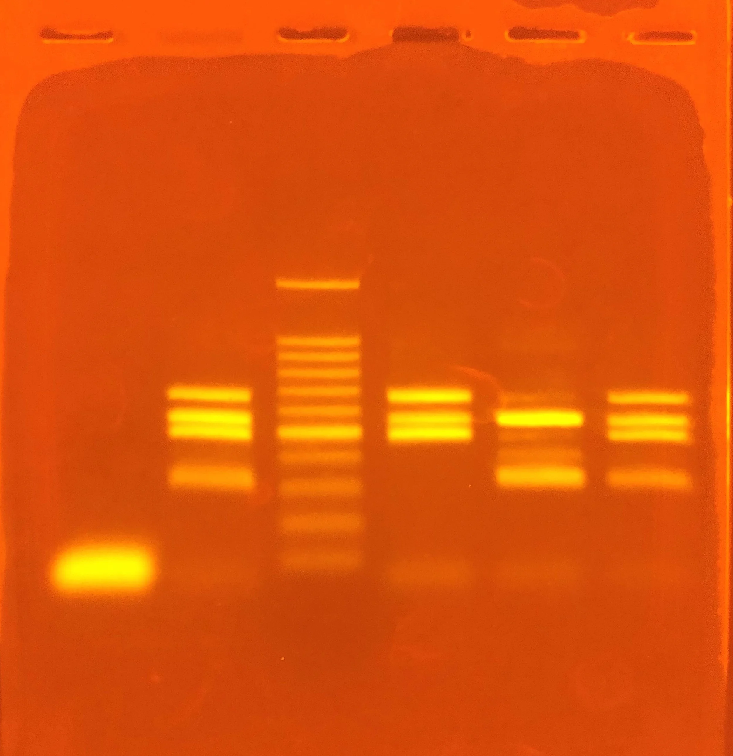 PCR Bacteria DNA ladder on Agarose Gel