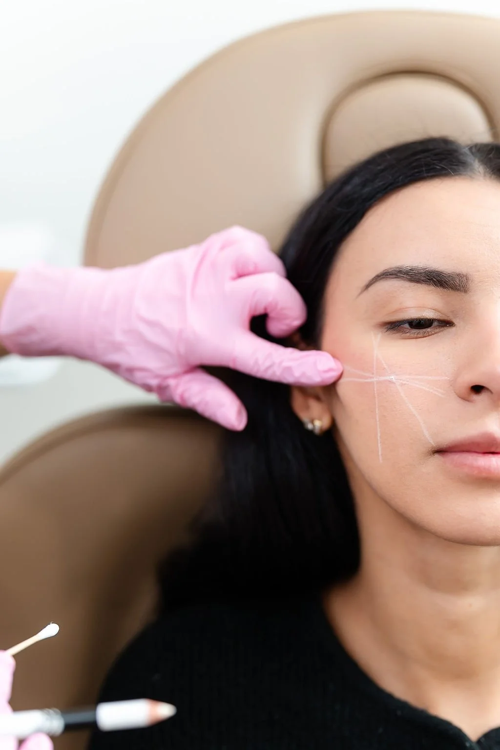 A woman receiving a cosmetic or medical treatment on her cheek from a professional wearing pink gloves, with markings on her face indicating targeted areas.