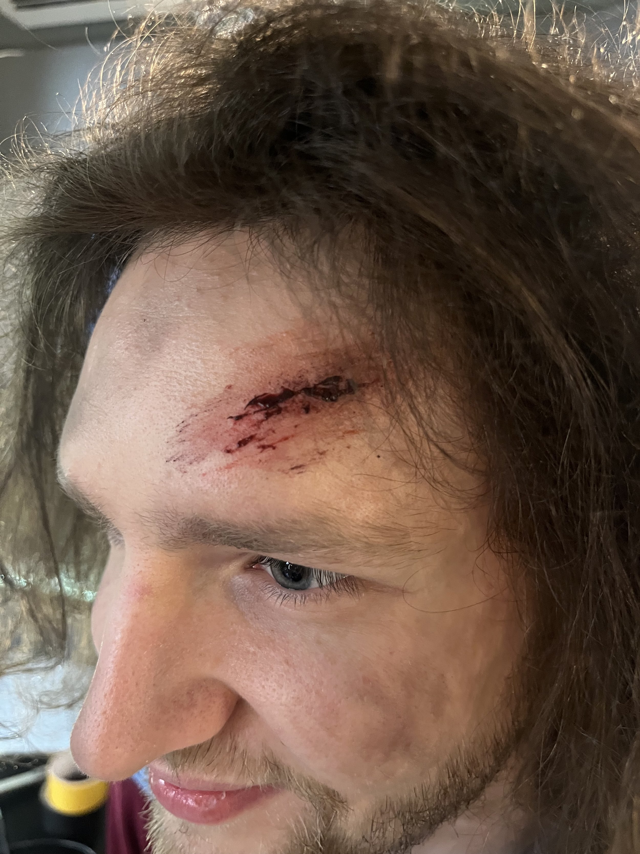 Make- up SFX - Schürfwunde