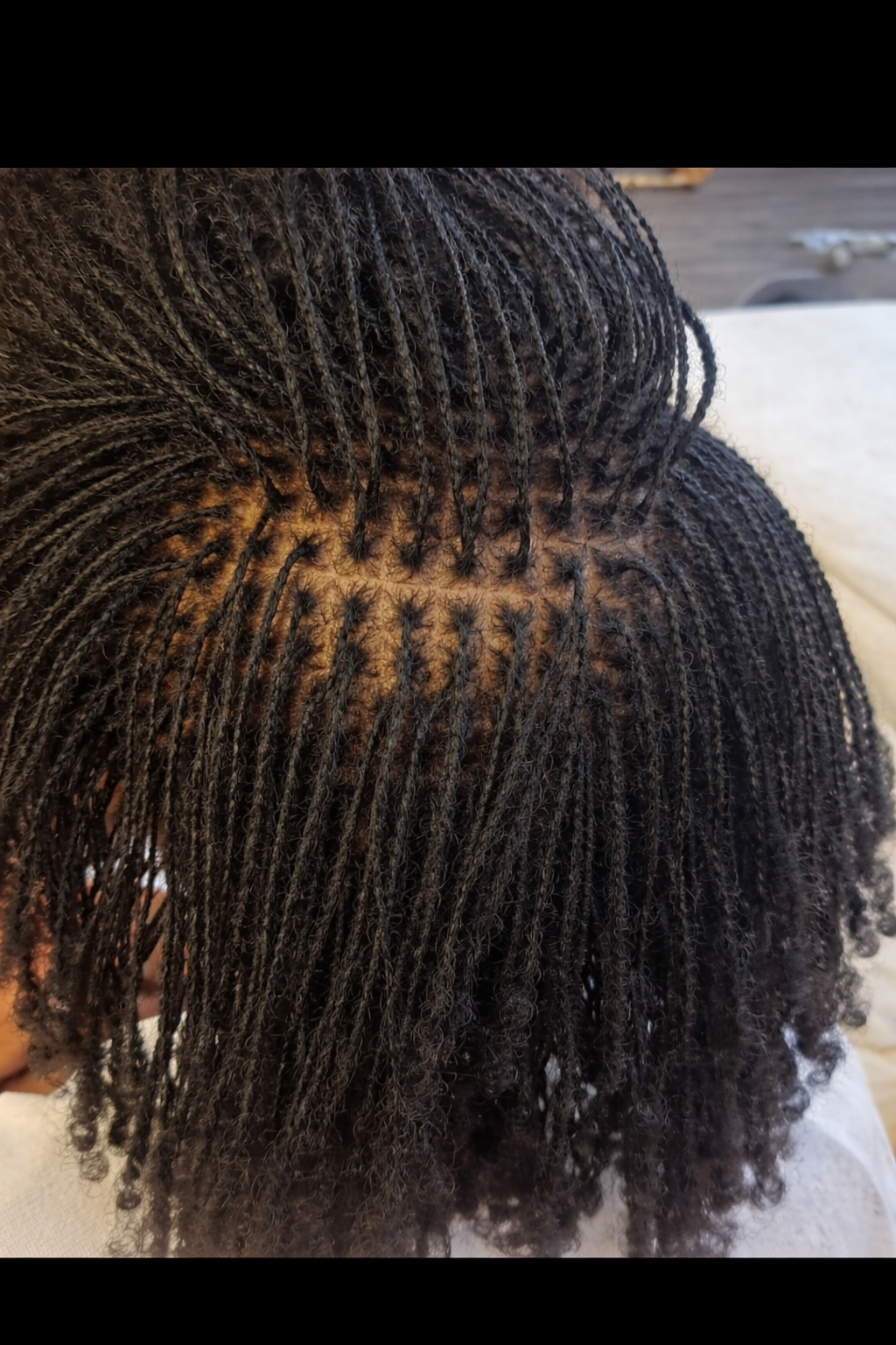Close-up of a person with freshly braided hair, showing the scalp and detailed small braids surrounding the head.