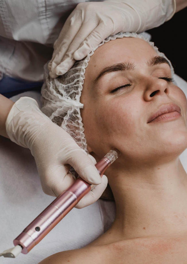 Medspa Services in Orangevale, CA, 95662 | Microneedling
