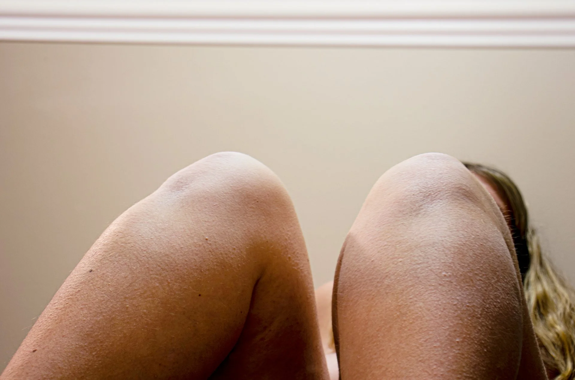 Epidermis