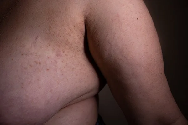 epidermis 1.jpg
