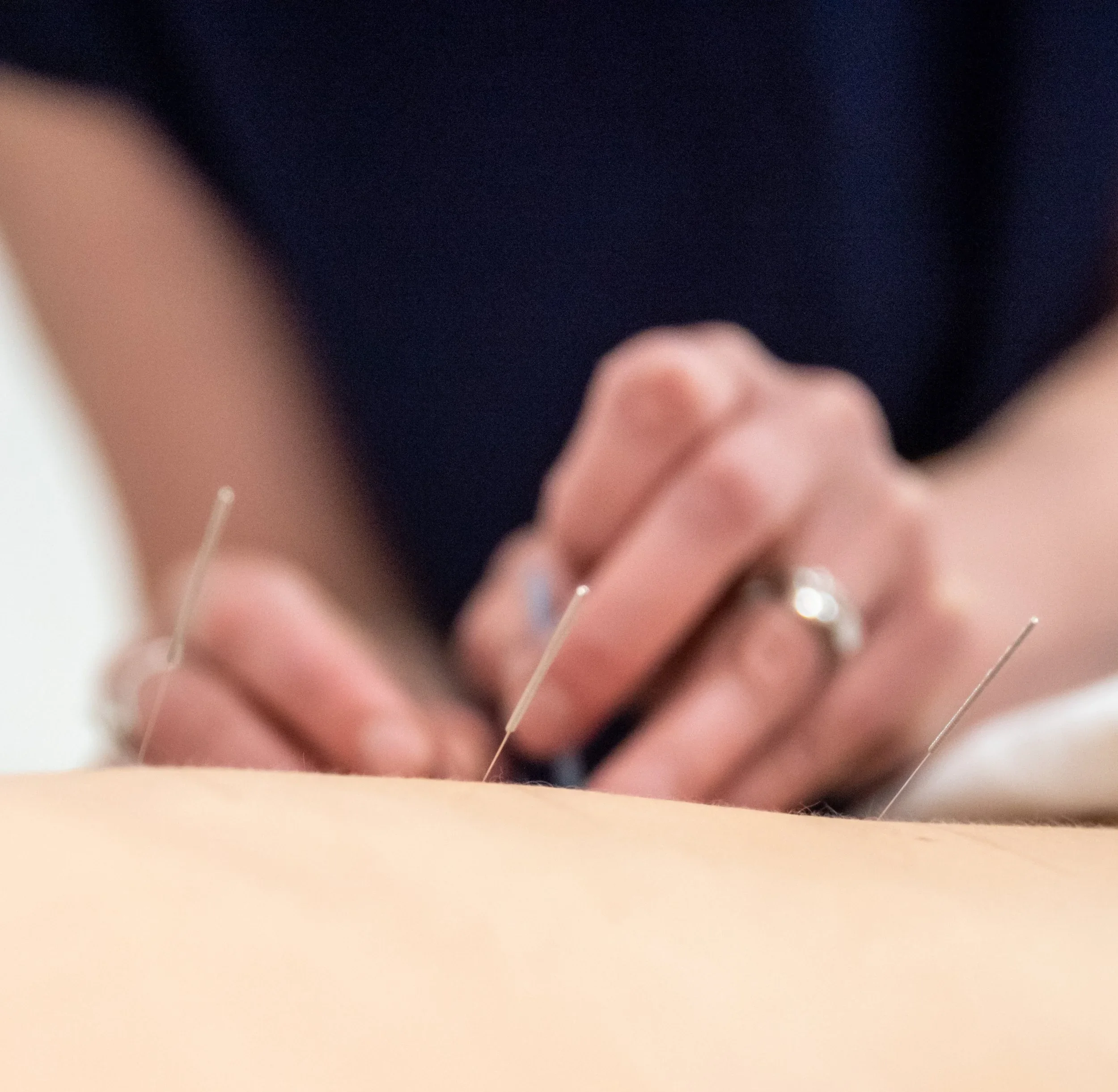 Becca Thomas-Registered Acupuncturist-Elk Valley