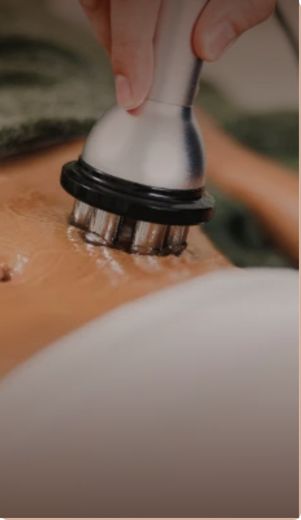 Woman receiving a skin tightening device treatment on her forehead. Links to Skin Rejuvenation and Tightening, including Clear + Brilliant, Thermage, and Ultherapy.