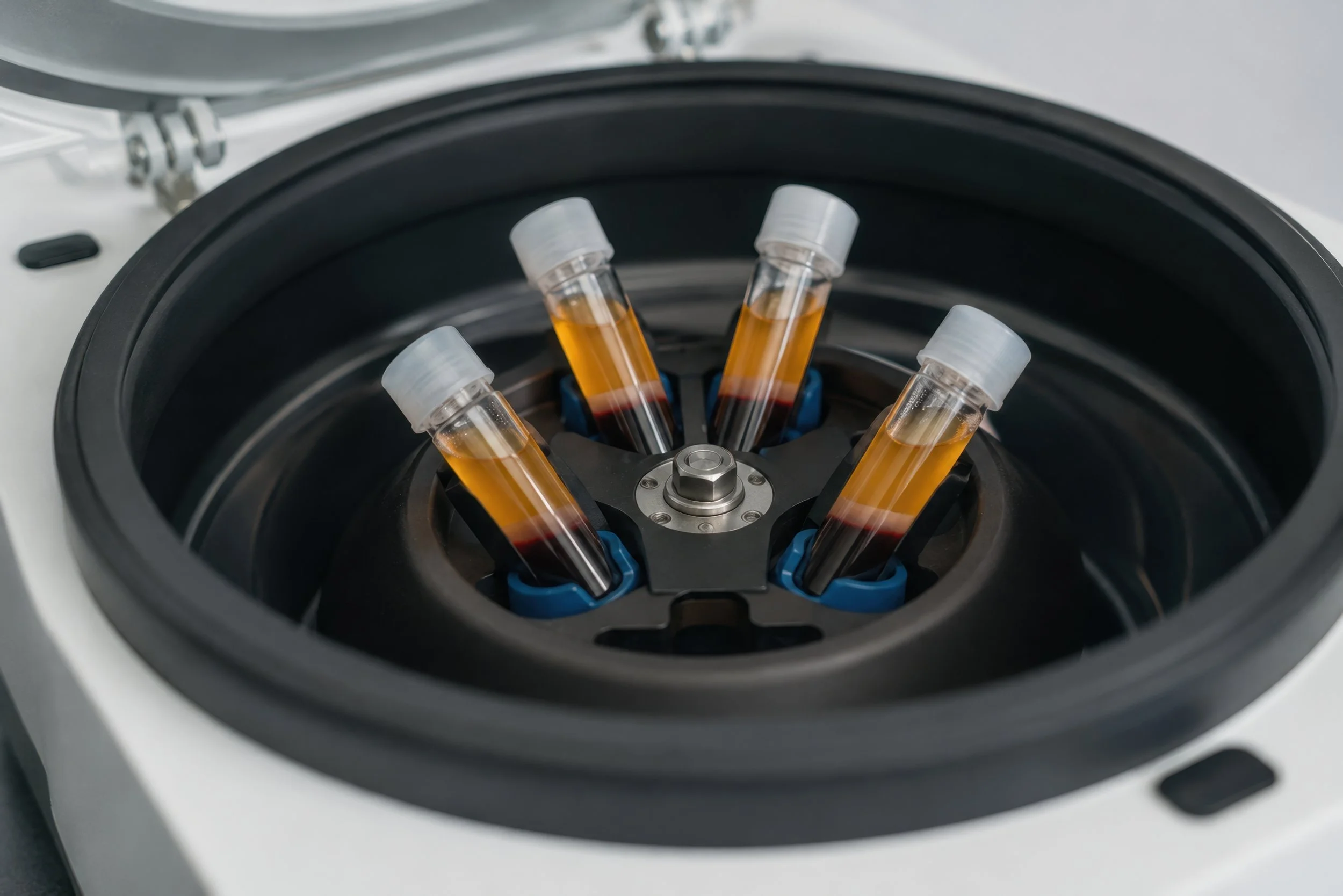 Medical centrifuge spinning blood collection tubes to separate platelet-rich plasma for PRP treatments.