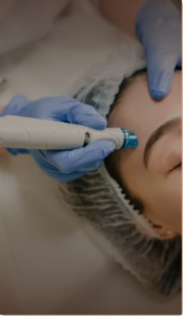 Woman receiving a microneedling treatment on her forehead. Links to Regenerative Treatments, including PRF and PRP.
