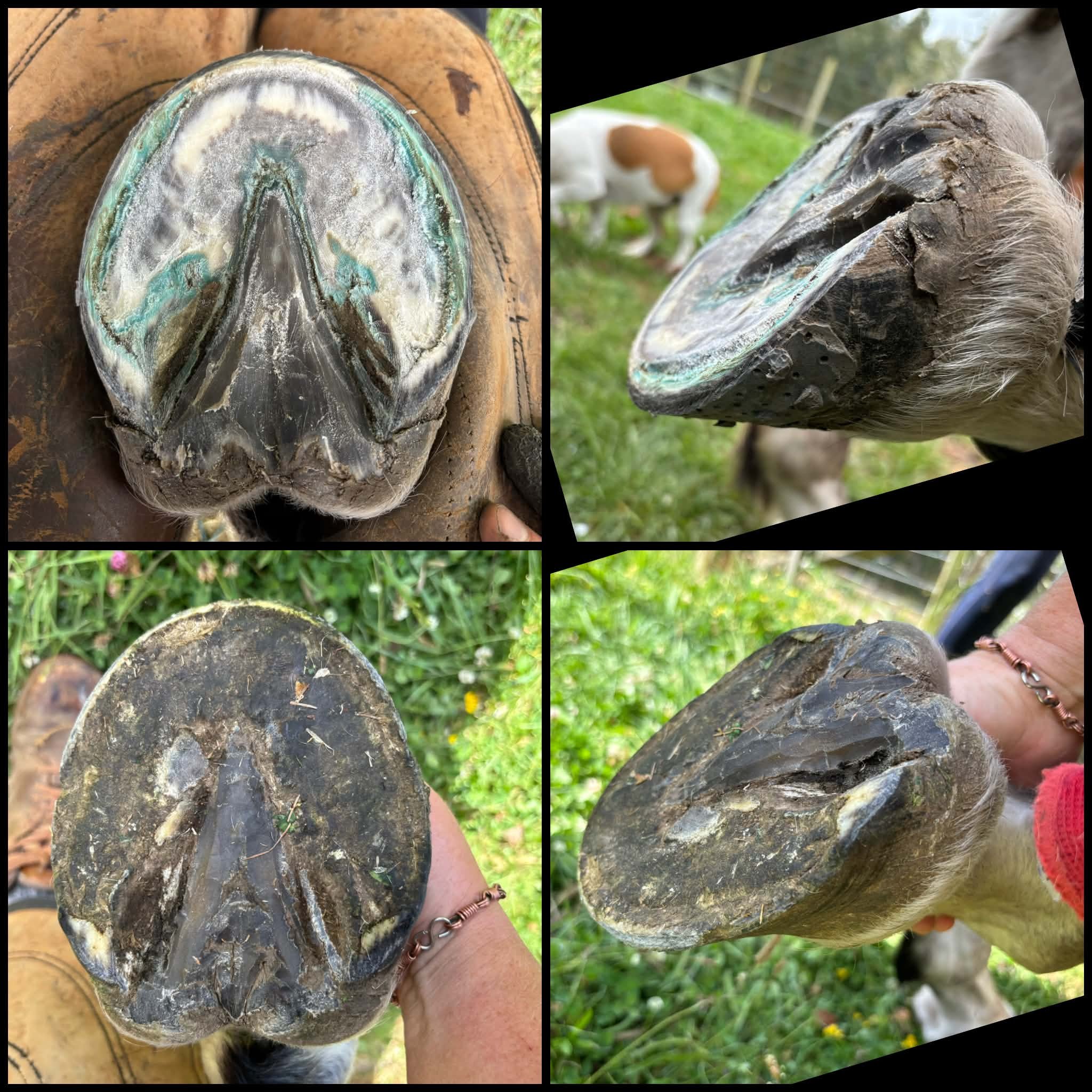 Restoring concavity and frog function with GG shoes