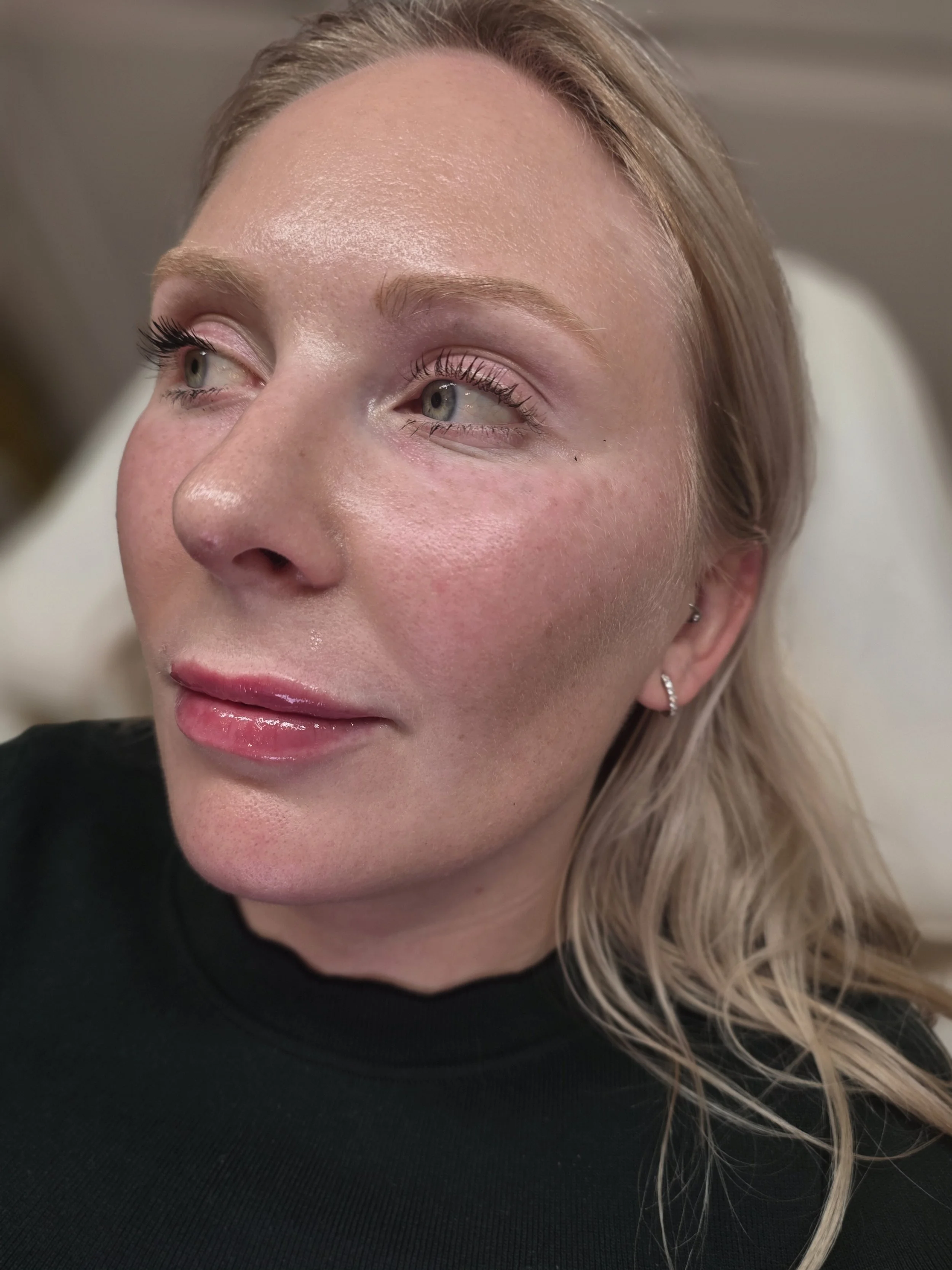 Natural Aesthetic Treatments