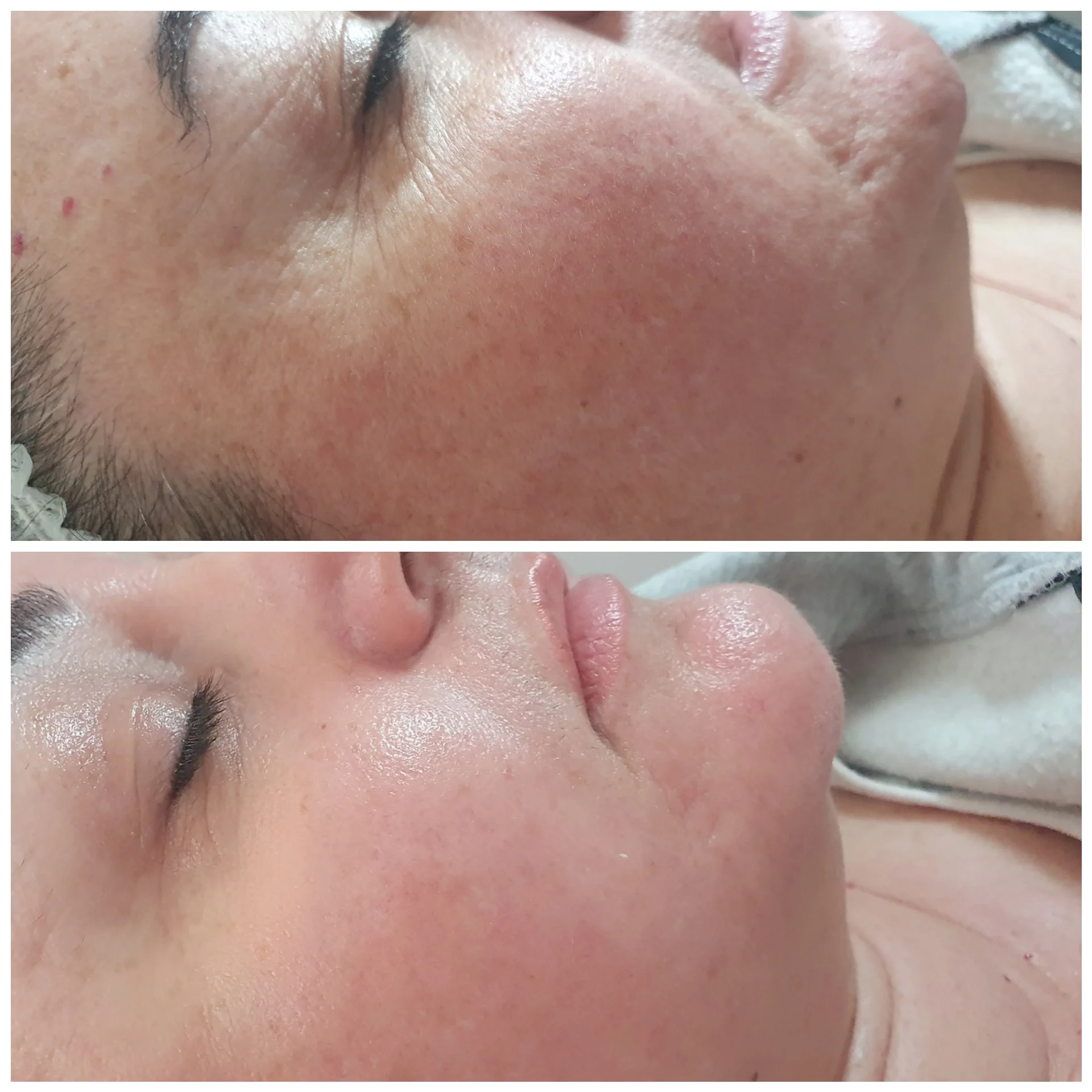 Before and After 