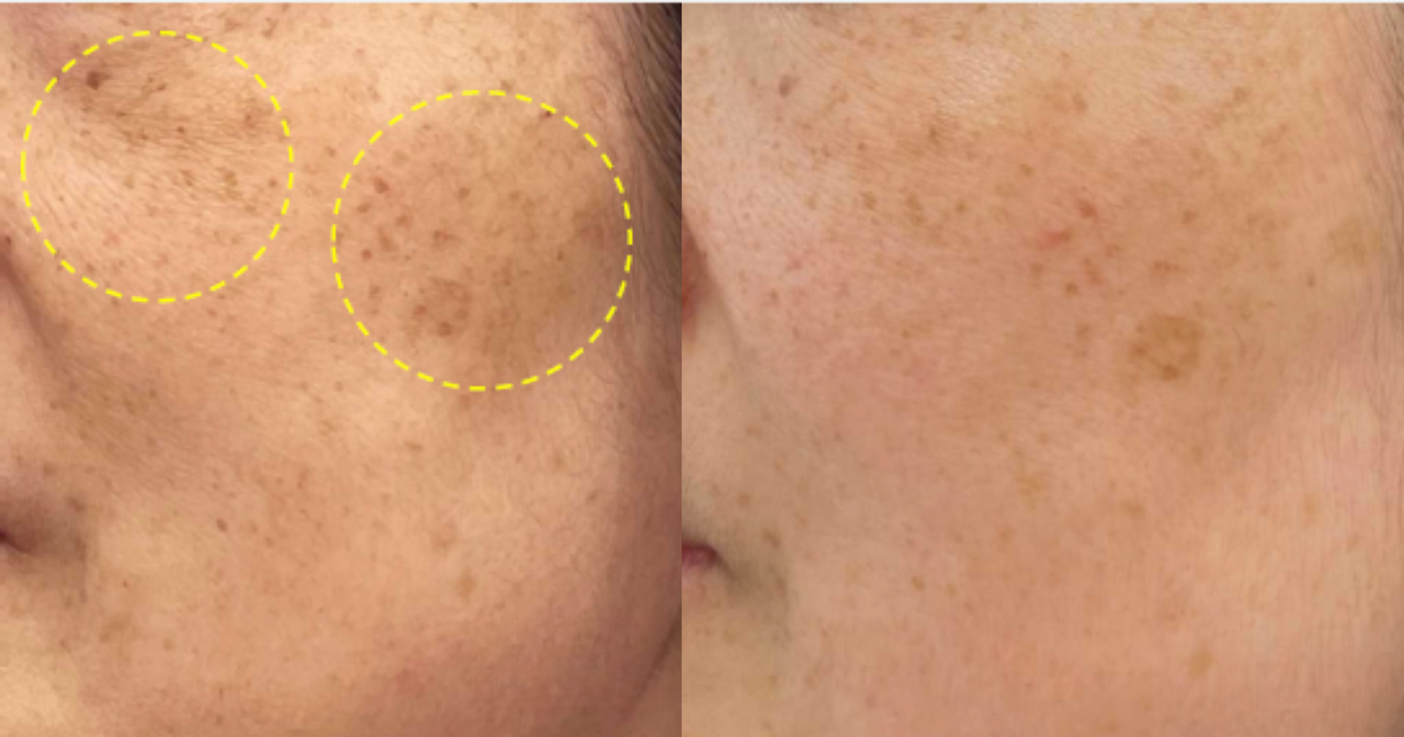 Before and After